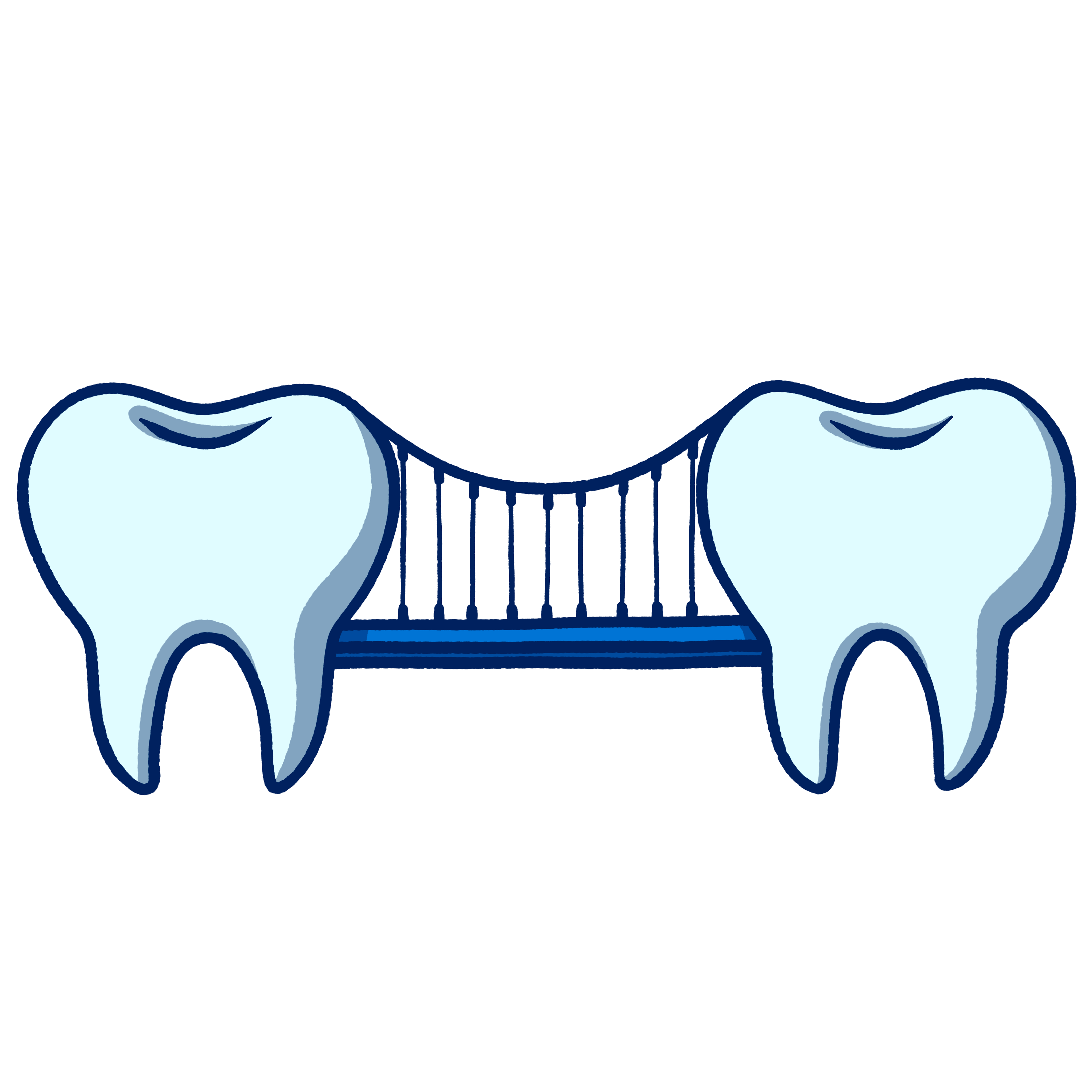 Dental Bridges