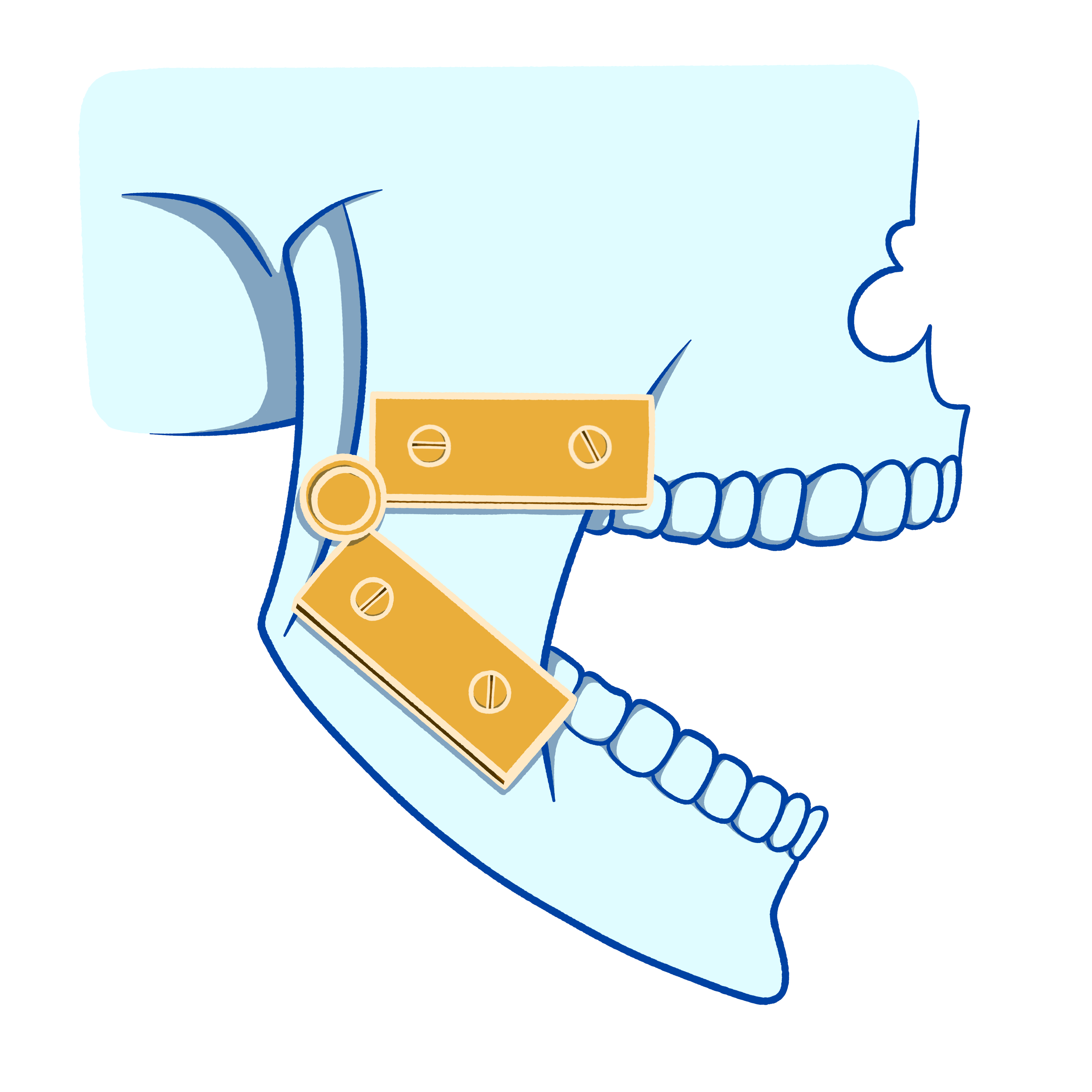 TMJ/TMD Treatment