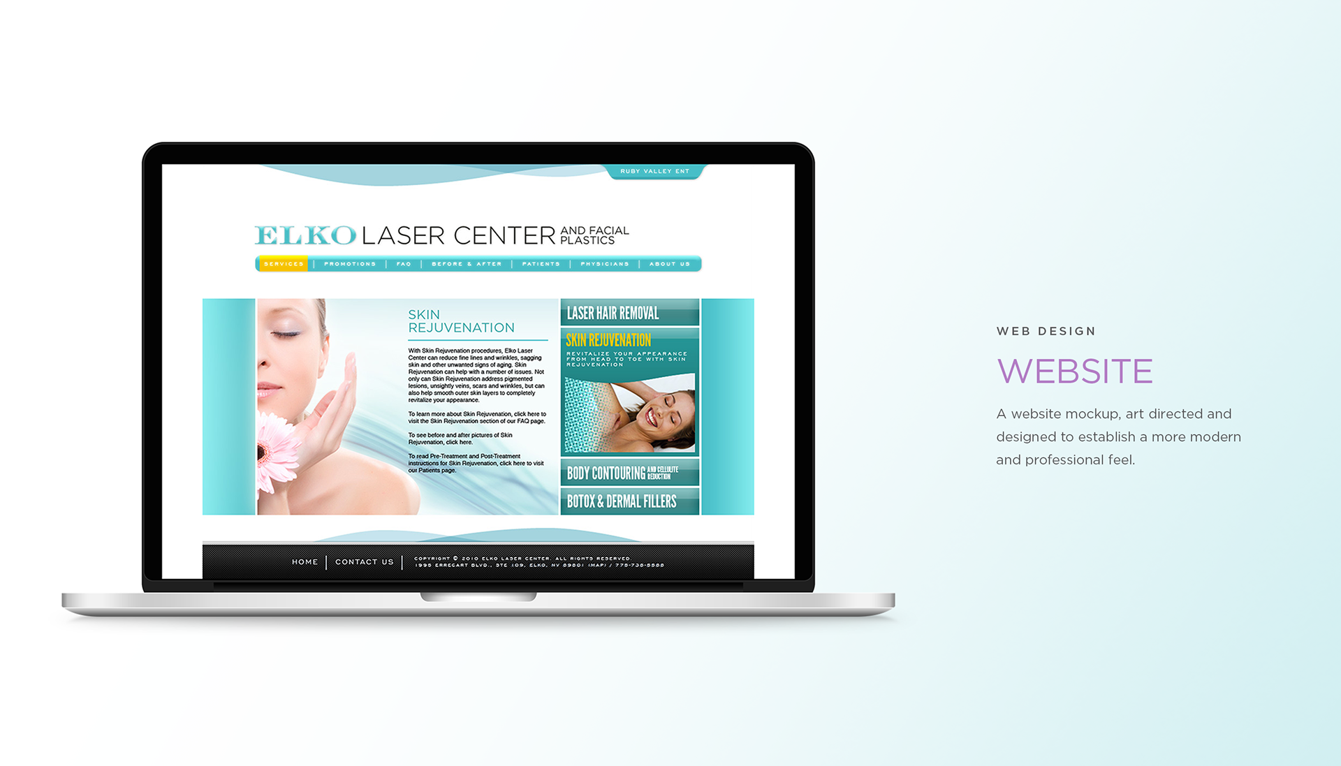 A website design for Elko Laser Center
