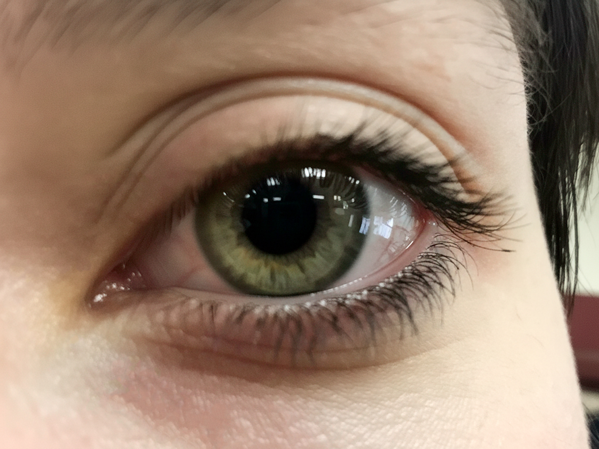 03 Eye of Clover