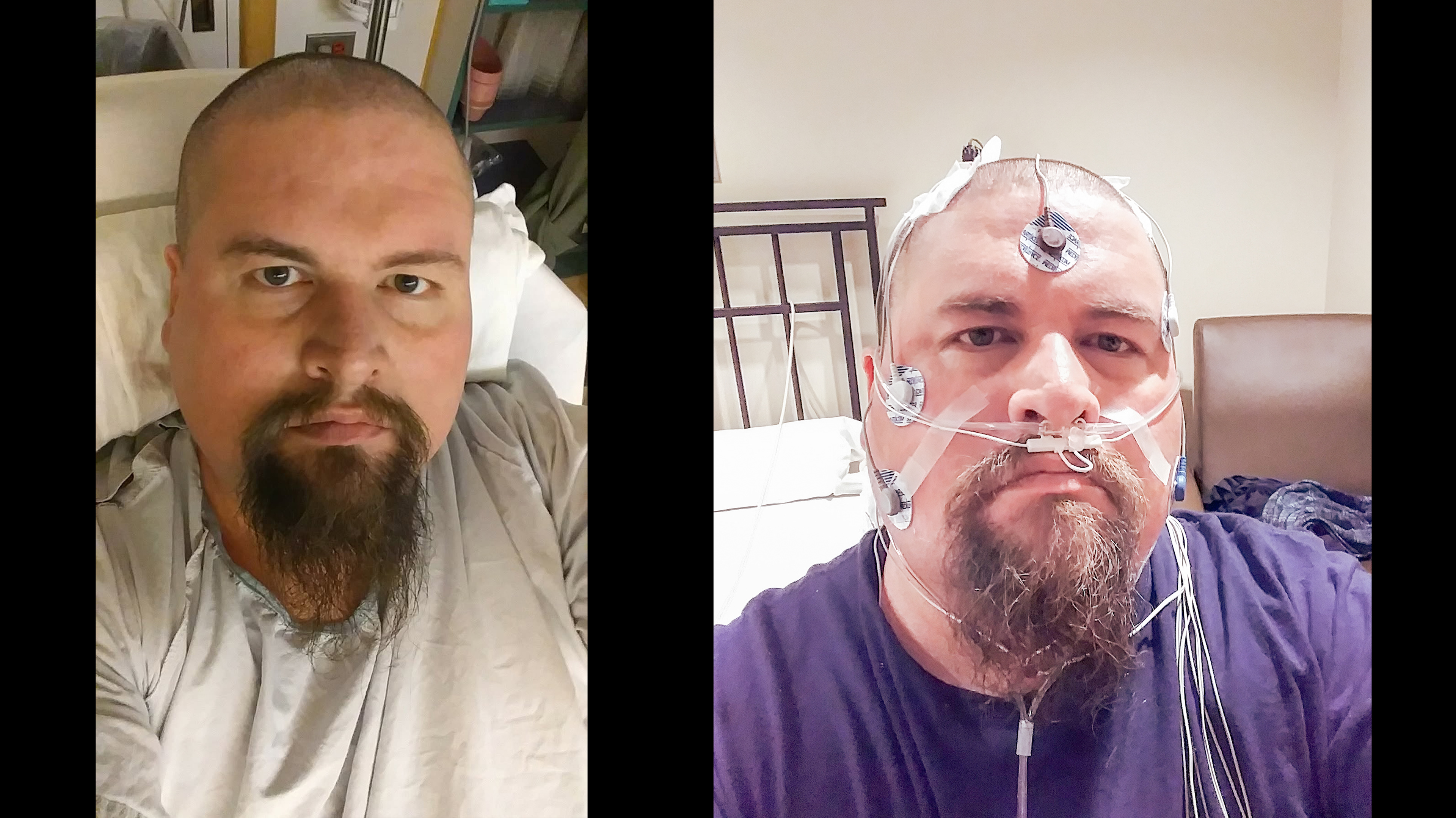 24 Pre/Post