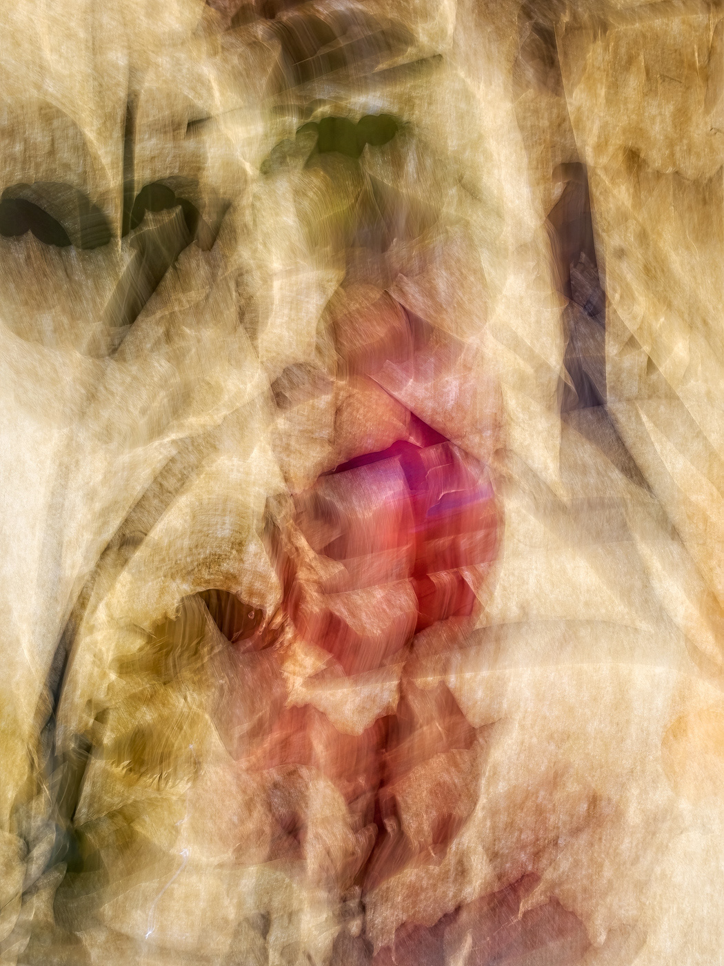 Spinal X-Ray