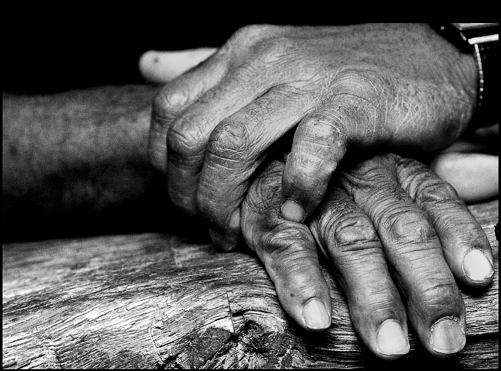 Poughkeepsie, Ny; Sept; 1995. The gnarled fists of former World Heavyweight Champion Floyd Patterson.