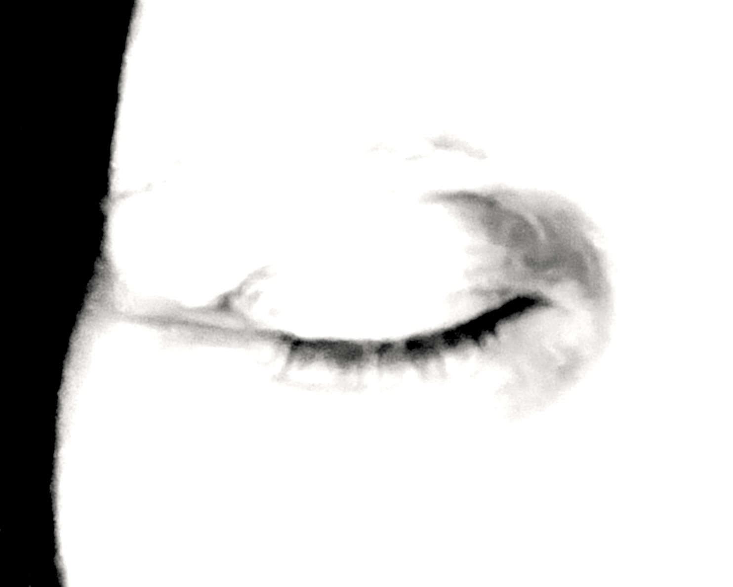 RIGHT—Sleepy Eye Pretense