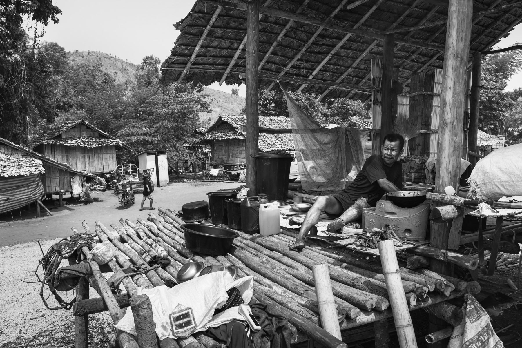 Internal displaced person (IDP) and victim of a landmine accident. Htaw IDP camp for Karen displaced people in Kayin State, Myanmar, May 2024