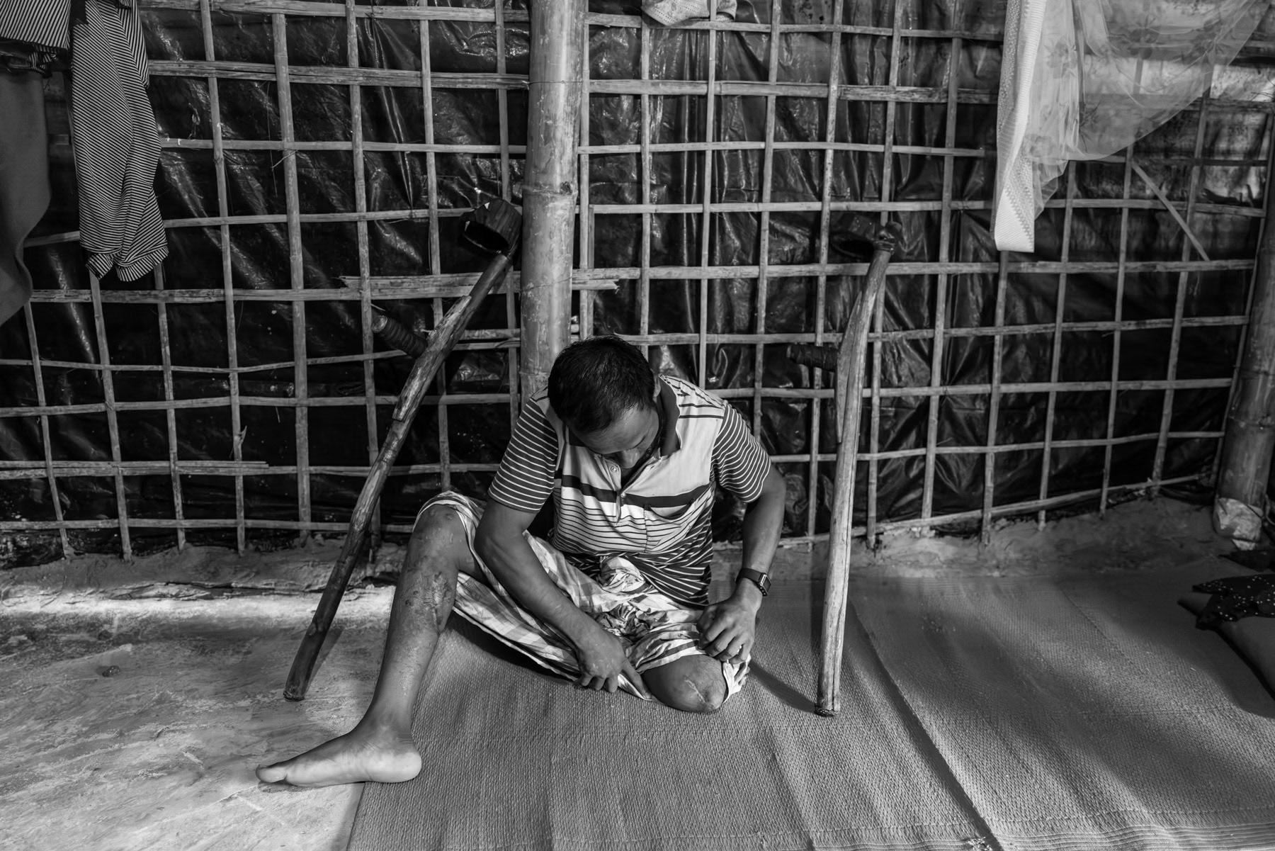 Abu Rahim, 32, from Lawidon village near Buthidaung, recounts losing his leg when the Arakan Army shelled his community in March 2024, shortly after ordering residents to evacuate. Dozens were killed and many more injured. Evacuated by the Arakan Army to Sandu village in Rathedaung Township, he was amputated in their medical facility and remained there for a year with other displaced Rohingya. He describes widespread extortion of villagers who were forced to contribute to the armed group’s war effort despite having lost everything. He arrived in Bangladesh in June 2025. Kutupalong refugee camp, Ukhiya, Bangladesh, September 2025