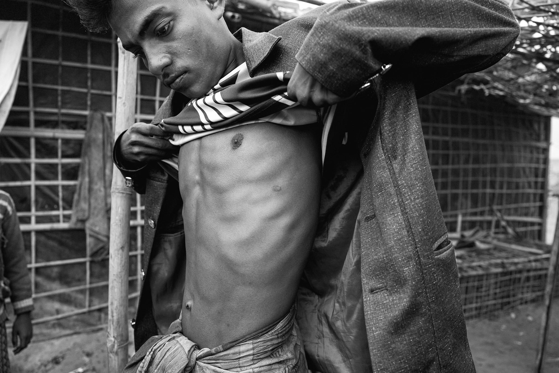 Huson Ahmed, 16, from Maungdaw, Myanmar; wounded by gunfire in August 2024; arrived in Bangladesh shortly after. Balukhali, Bangladesh, January 2026.