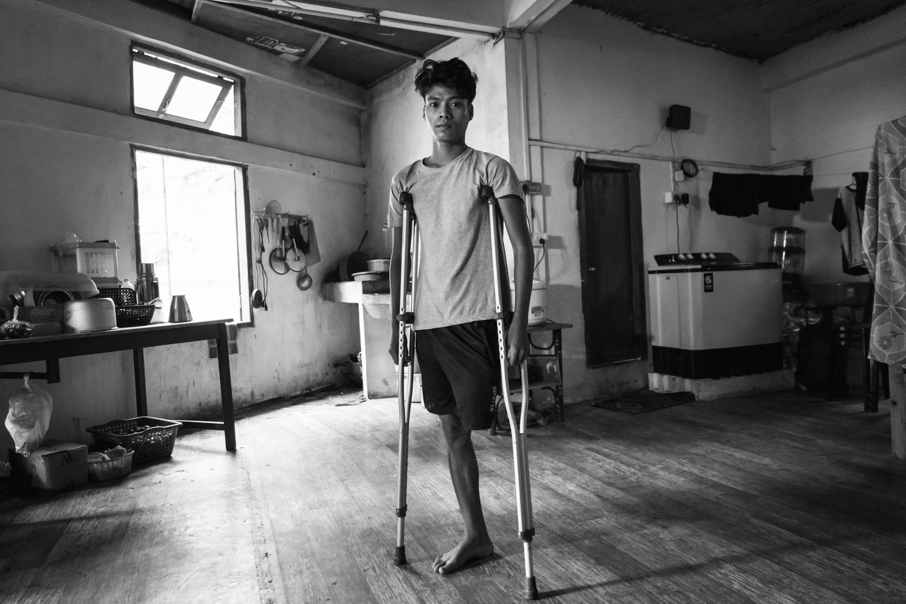 Member of the Chin Defence Forces (CDF) who was amputated after stepping on a landmine in Paletwa in southern Chin State. It took more than 48 hours to have him evacuated from the frontline to Aizawl hospital in India where he got treatment and the amputation. Safehouse in Aizawl, Mizoram, India, September 2022