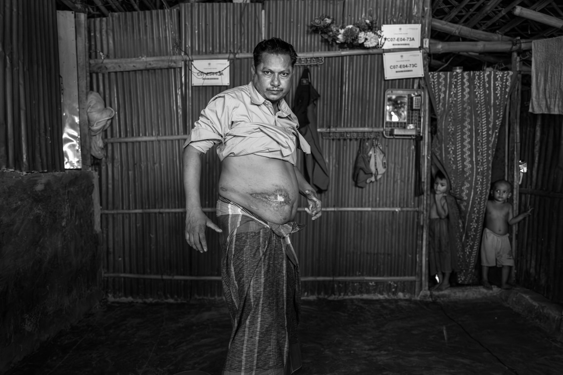 Rohingya survivor Korim Mullah, 35, shows scars from the abdominal injuries he sustained when a drone strike hit his family as they fled toward Bangladesh on 6 August 2024. The attack, carried out by the Arakan Army, killed his 7-year-old daughter. Speaking in September 2025, he recounts surviving multiple shrapnel wounds that required emergency treatment by Médecins Sans Frontières and ongoing medical care, with further fragments still lodged in his abdomen, leg, and arm. Kutupalong refugee camp, Ukhiya, Bangladesh, September 2025