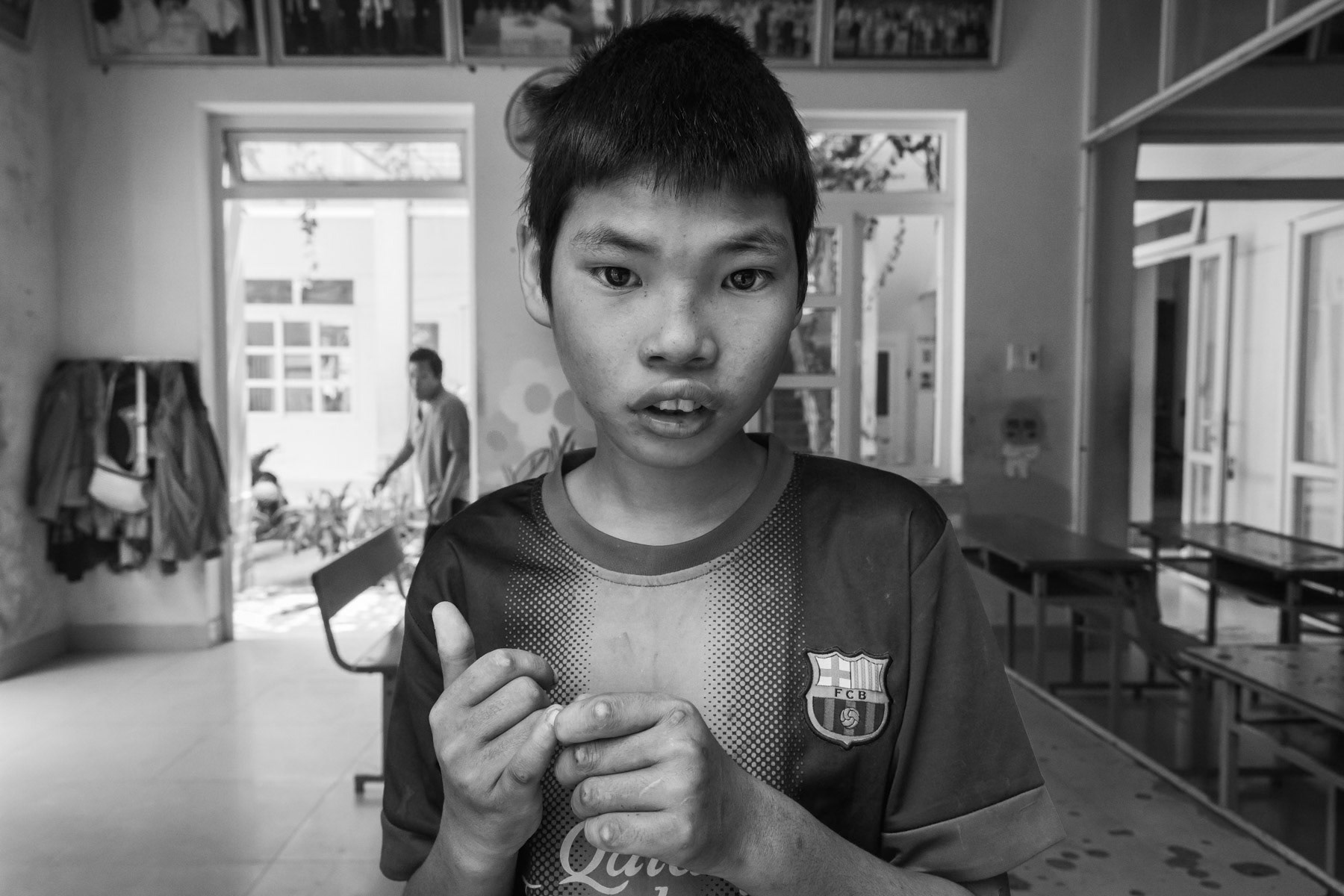 Agent Orange victim in a day care centre managed by the Vietnamese Association for Agent Orange Victims (VAVA). Agent Orange is a chemical defoilant rich in dioxin that was massively used by the American Army in clearance operations during the Vietnam War. Although its use was stopped in 1971, almost 50 years later desendants of affected victims are still born with mental and/or physical problems due to the toxicity of the dioxin passed on through generations. Da Nang, Vietnam, April 2018