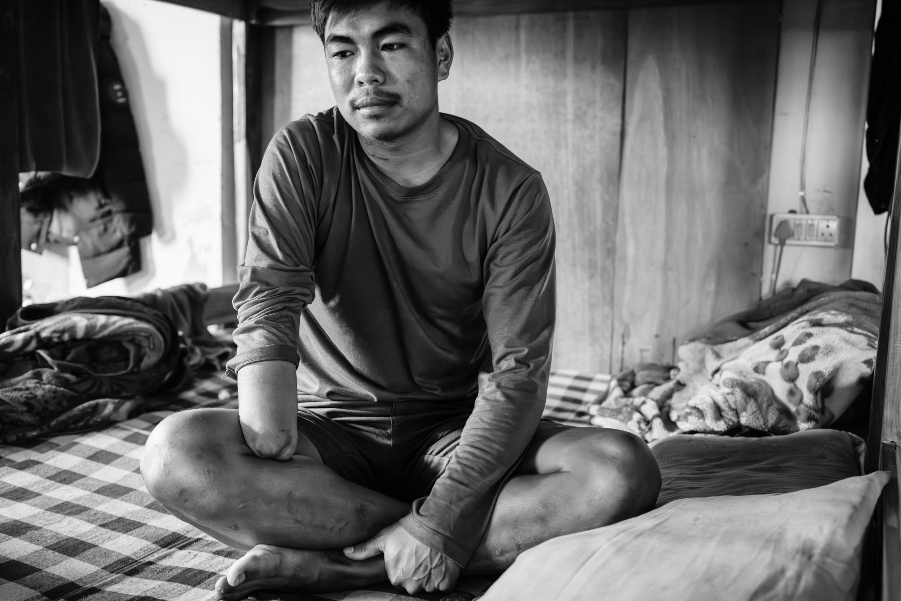 Chin National Army (CNA) soldier in a safehouse in Mizoram where at present 22 injured soldiers stay for futher treatment and surgery following amputations on the battlefield. CNA safehouse in Aizawl, Mizoram, India, April 2024