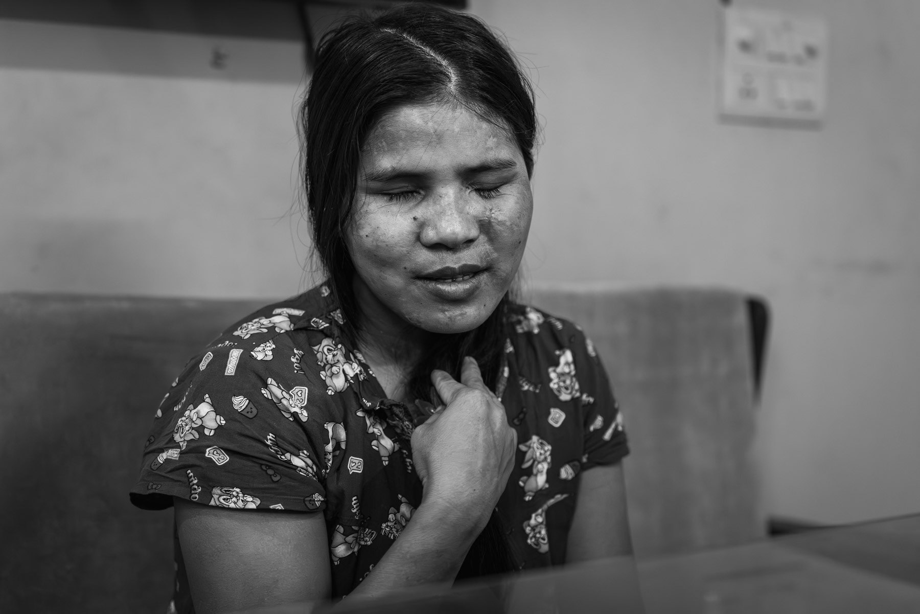 Pamsang, 29 years, is from Matupi in Chin State in Myanmar and was a civilian victim of an airstrike on her house. The military dictatorship carried out airstrikes on 15 November 2023 in Wanglu village near Matupi. Her 3 children, husband and bother in law died instantly. That day 11 people died in the village, mainly young children. She was treated for severe head and leg wounds in hospitals in Mindat and Mandalay before making her way to Aizawl in India for further surgery. Now in New Delhi for eye surgery as she is totally blind since the airstrike. Her right eye is lost and a marginal sight recovery on the left eye has occured since the eye surgery. The military regime in Myanmar has systematically used air strikes on civilian populations, schools and medical facilities without any military goal except traumatising the population and committing relentless unpunished war crimes. Chin community safe house in New Delhi, India, May 2024