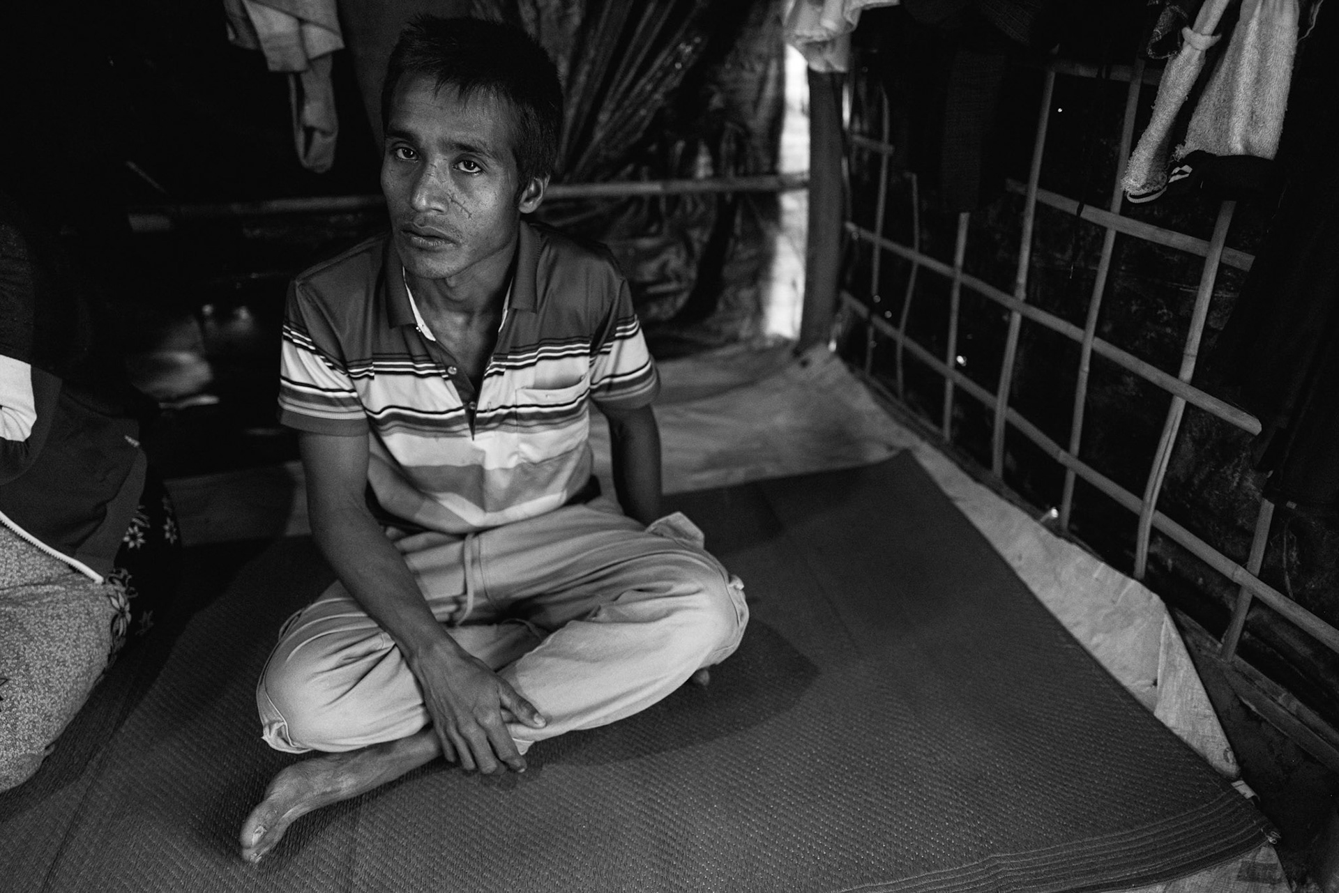 In February 2024, the lives of Md Toyub 30 years (photo) and his wife Sajida, 33, were upended when a drone strike targeted their home in Emudin Para, Buthidaung Township. The attack, which occurred on February 19, left Sajida with critical leg injuries.Just three days later, the Arakan Army (AA) arrested and tortured Toyub, leaving him unconscious in a field until villagers rescued him. After paying for Sajida’s medical treatment at an AA-controlled clinic, the family spent four months displaced in a neighboring village. To escape the violence, the community raised $2,000 to evacuate Toyub and their three sons (ages 3, 9, and 16) to Bangladesh. Sajida was finally reunited with her family later after an additional $1,200 was paid for her evacuation. Kutupalong refugee camp, Bangladesh, January 2026