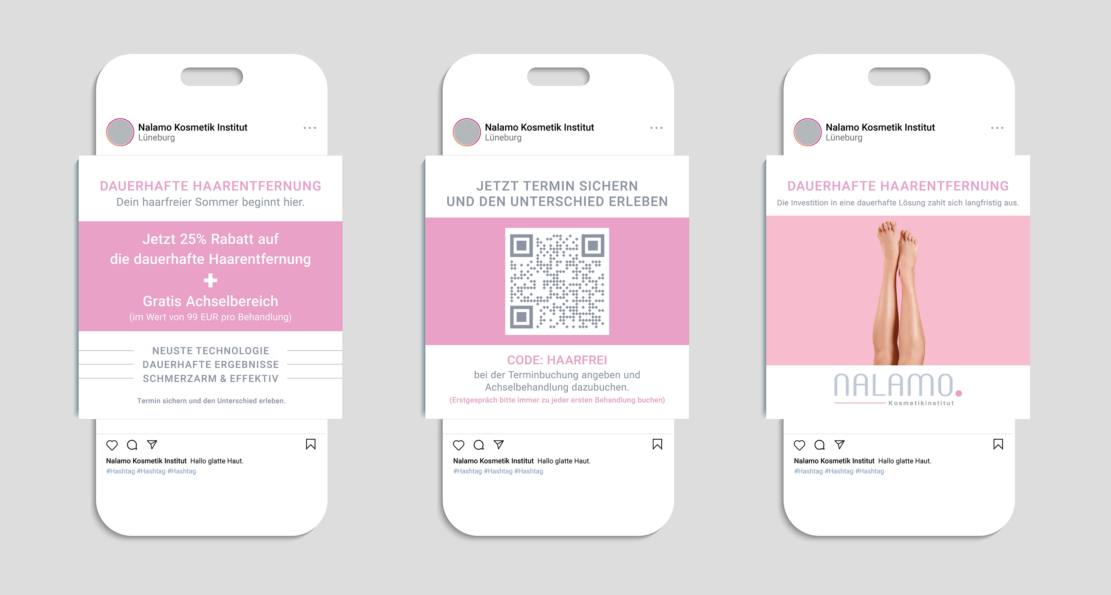 Nalamo IG Feed - Permanent Hair Removal