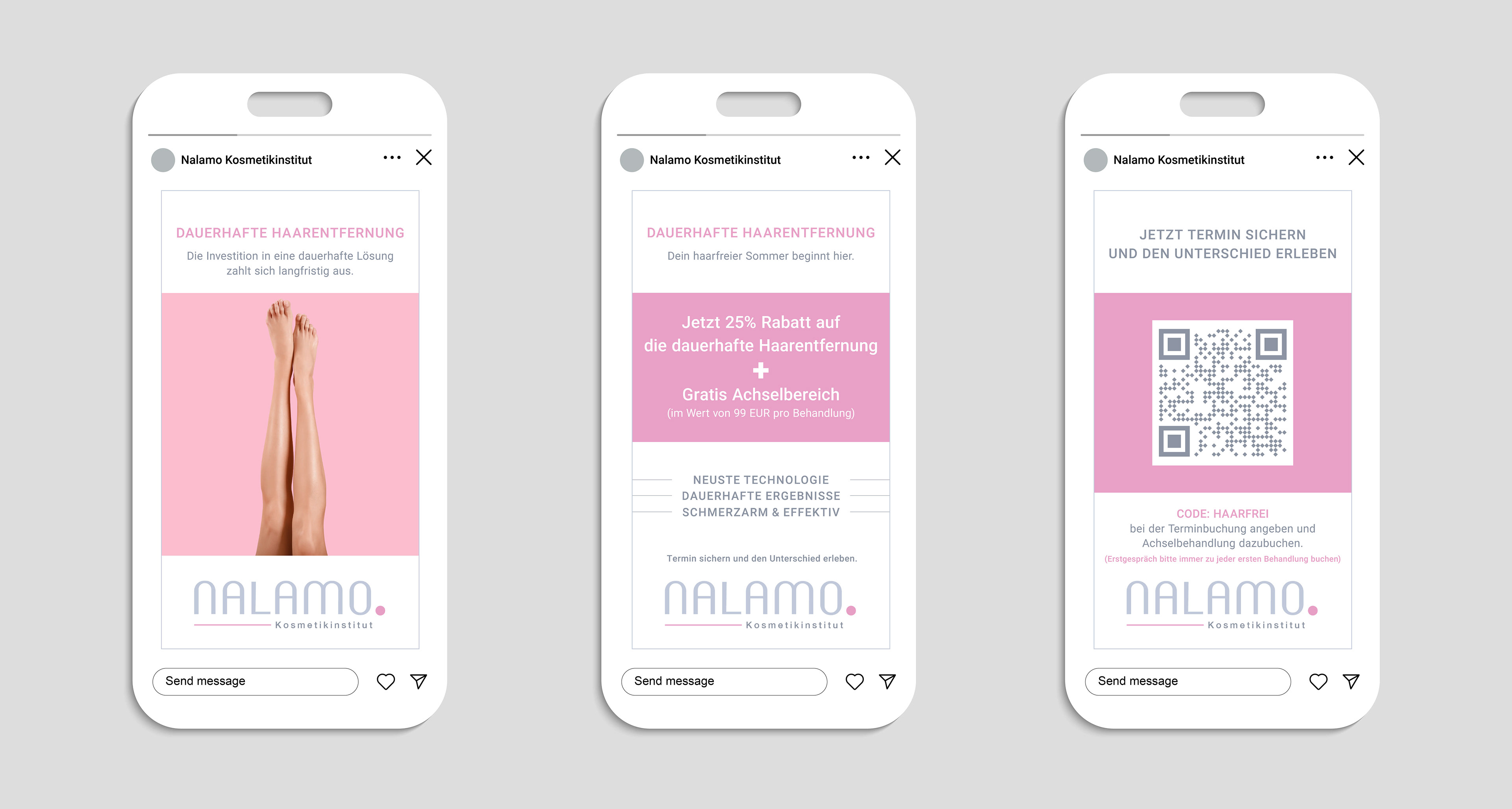 Nalamo IG Story - Permanent Hair Removal