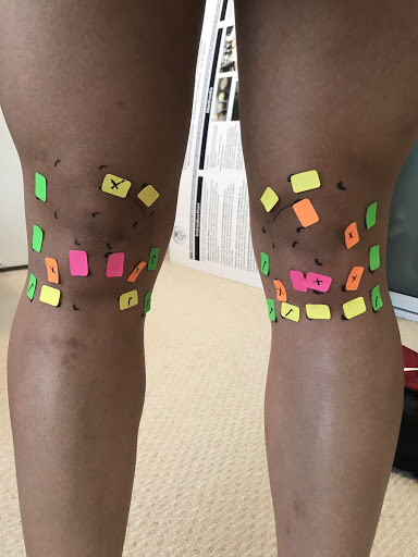 after testing knee skin strain
