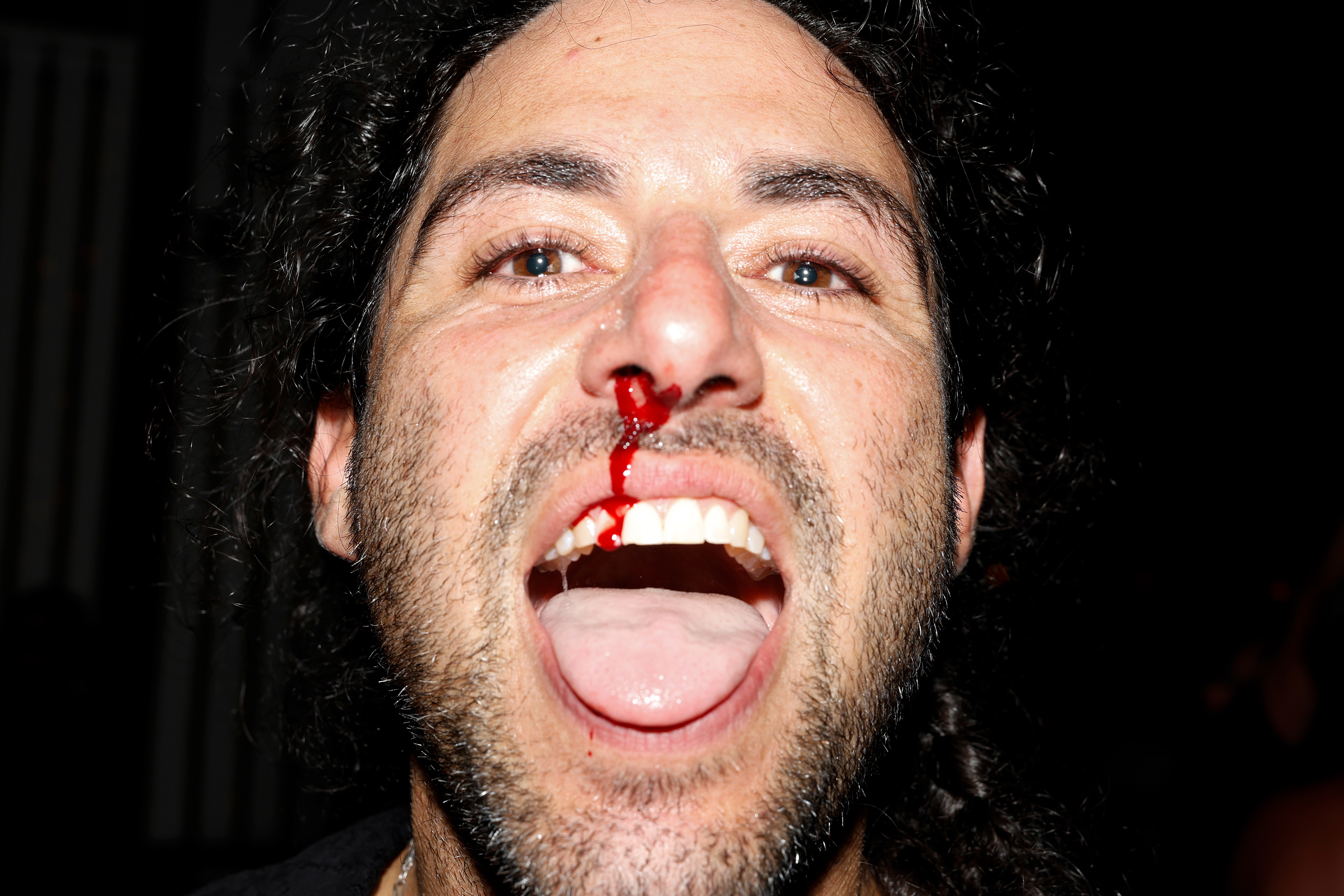 Ryan Parga comes out of the mosh pit with a nosebleed during Live Punk at Bright Eye on Saturday, July 3, 2026 in Long Beach, N.Y.
