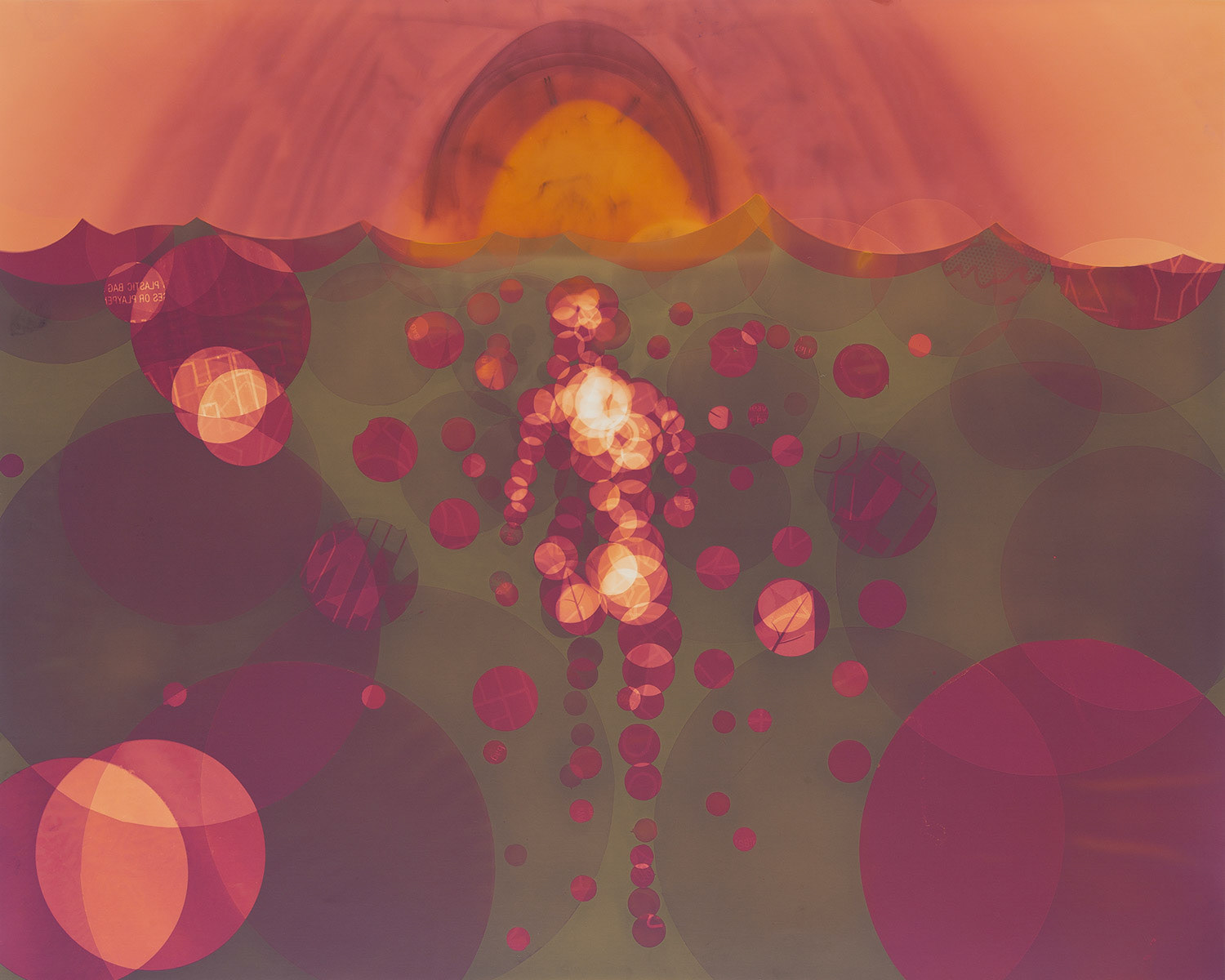sunburn 4