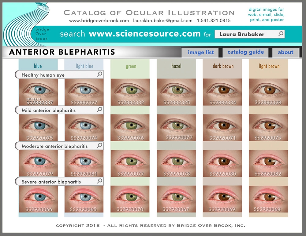 Catalog of Ocular Illustration