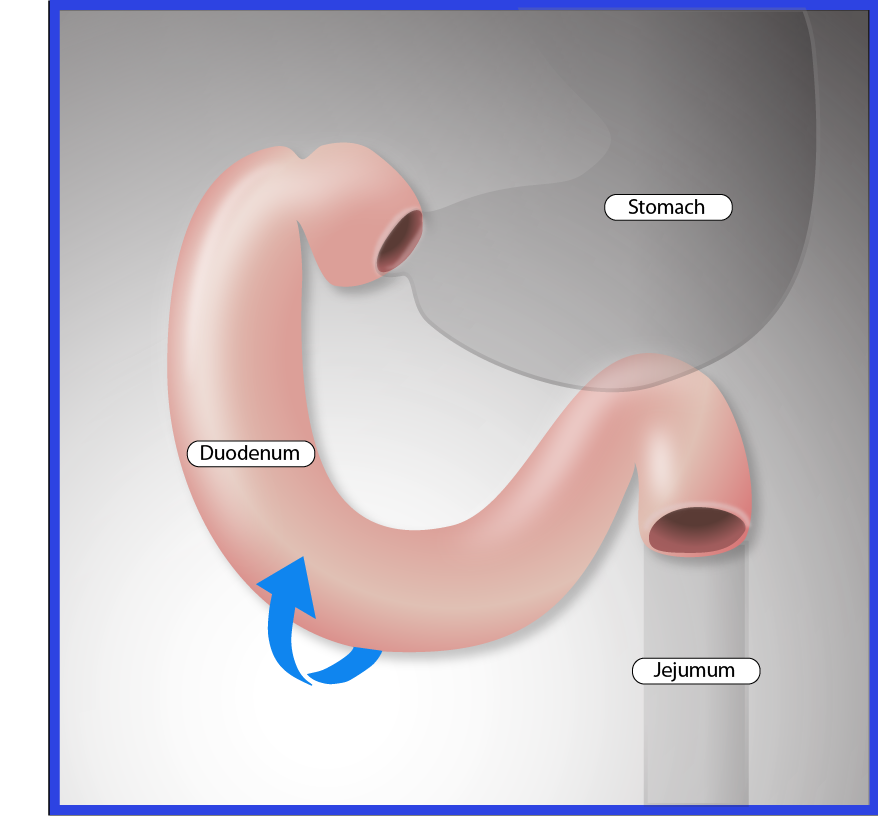 Closeup of area of interest with anatomical markers