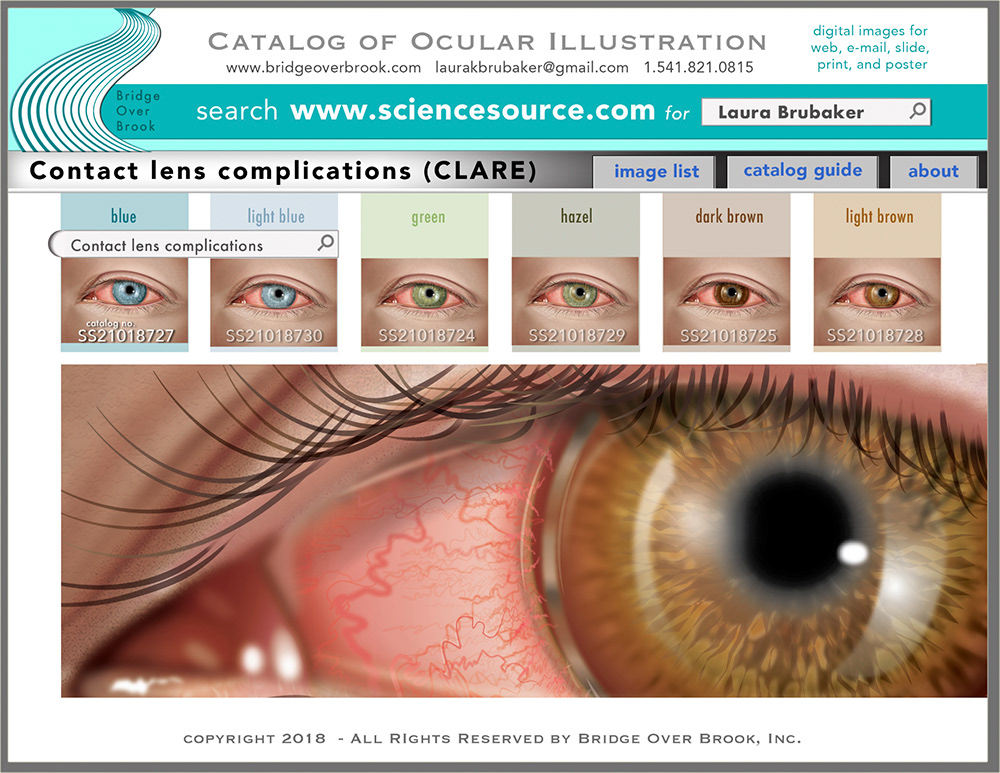 Catalog of Ocular Illustration - CLARE