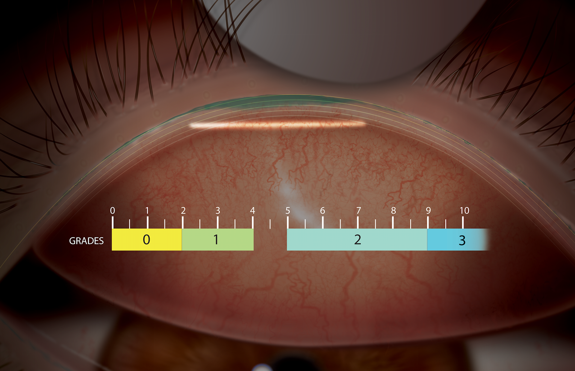 Slit lamp evaluation