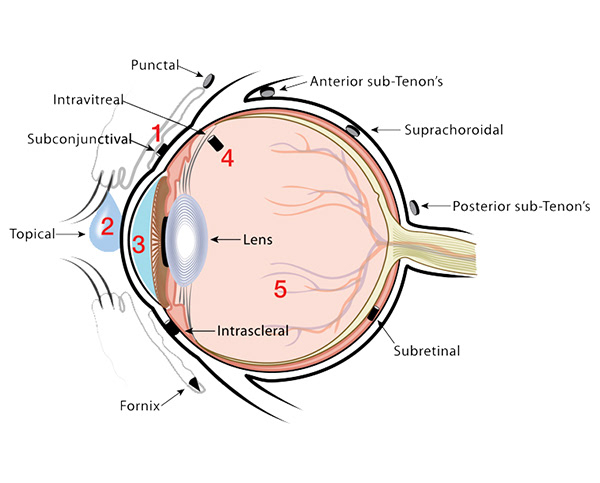 Eye Implantation Sites