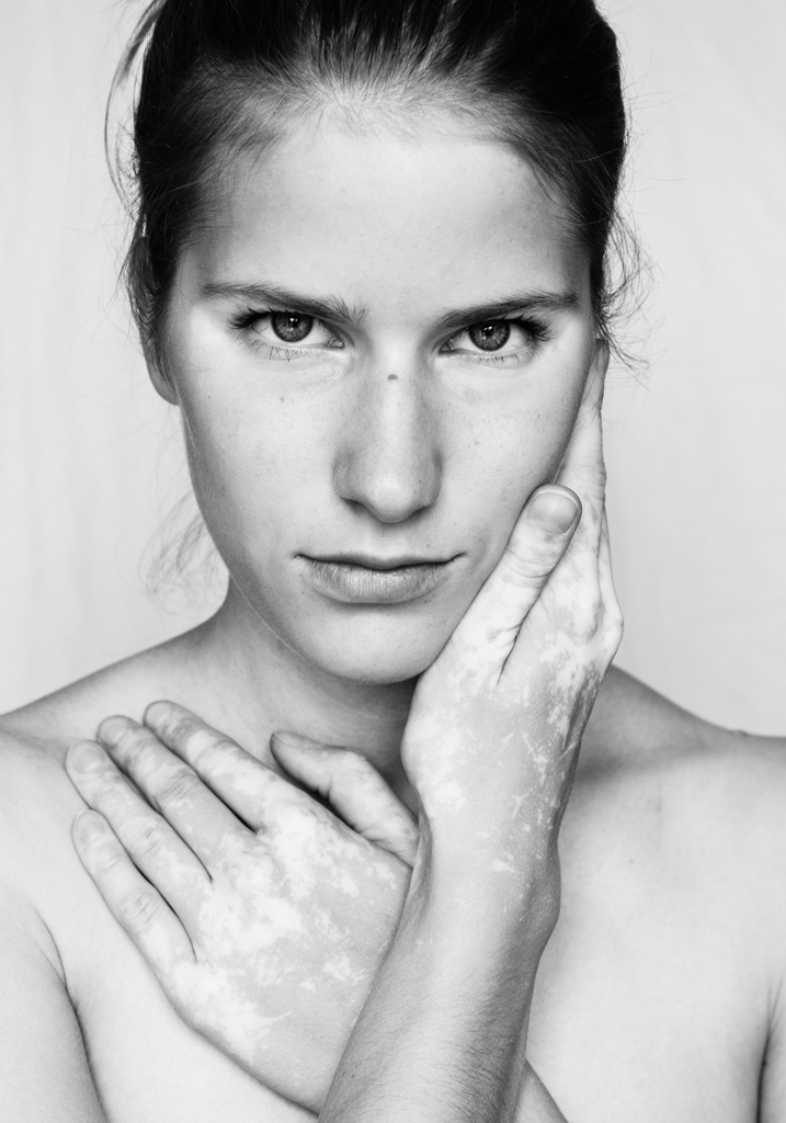 Text: Black and white headshot. Self portrait of Julia Kaczorowska. She has a lascivious look in her eyes as she crosses her arms in front of her chest, 1 hand placed on the clavicle and the other cradling the side of her face. She has a light skin tone with spattered vitiligo patches on the top of her hands.