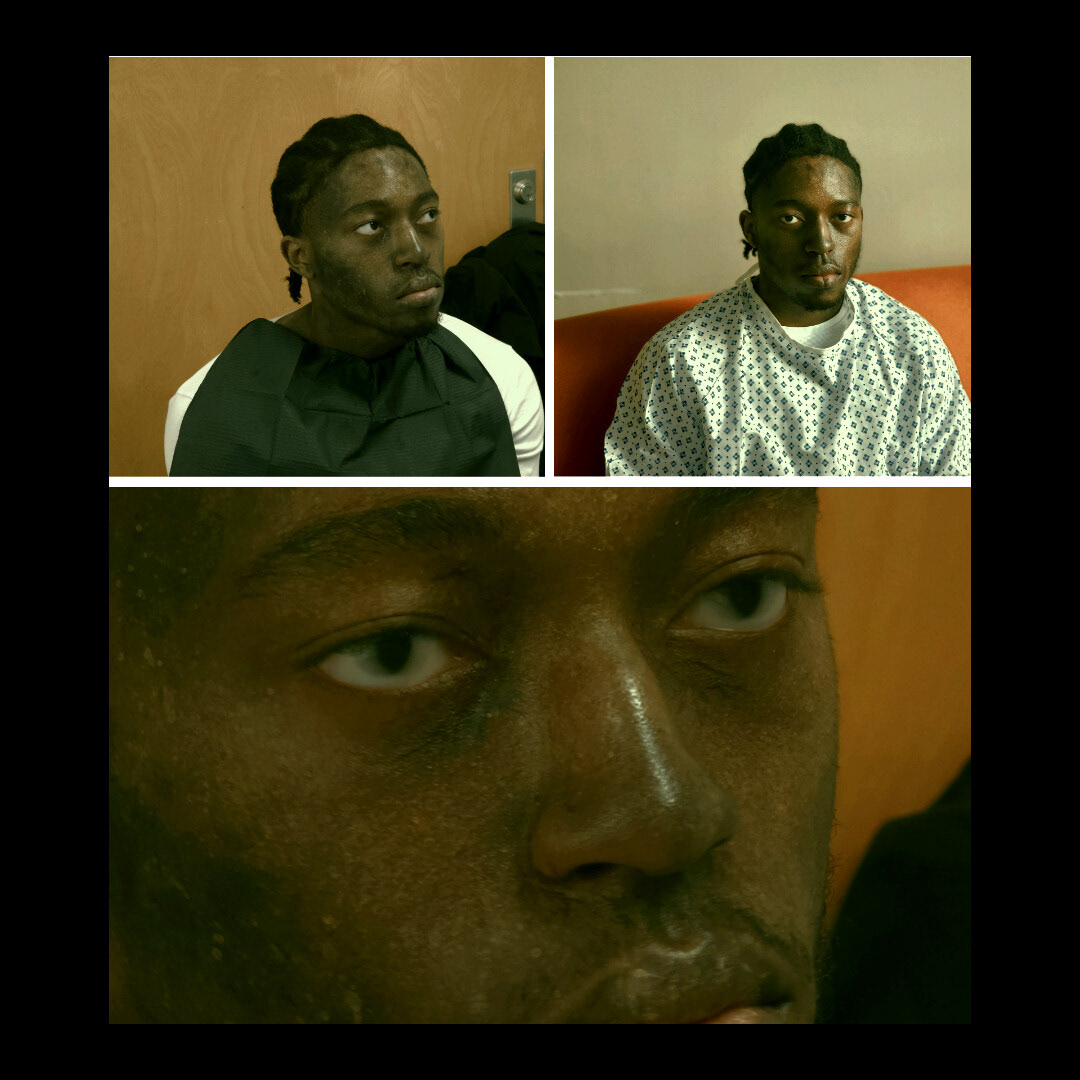 Patient #1 (Robert Hamilton Jr.) BTS