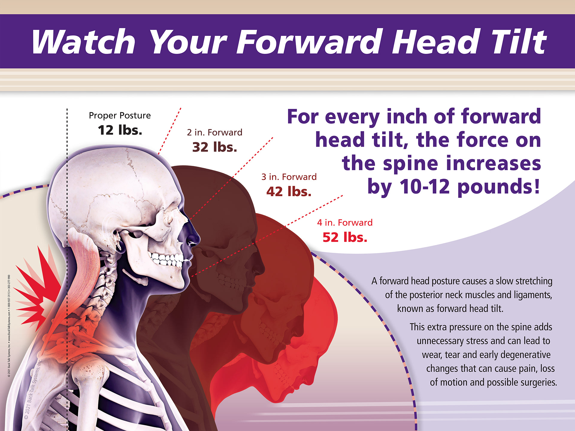 Chiropractic poster design collaborated with design manager