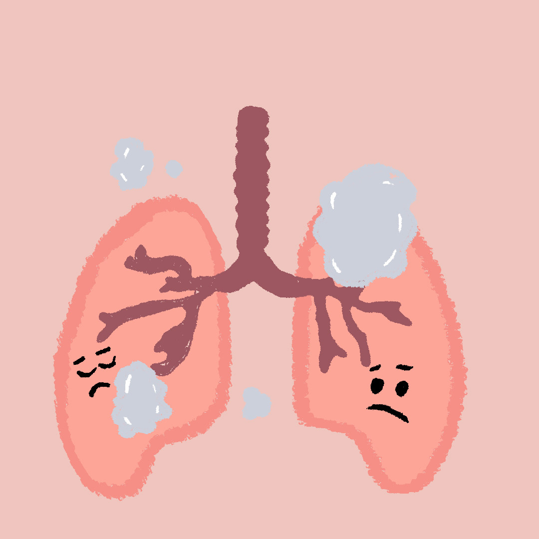 Air Pollution gif 5 Unicef module
