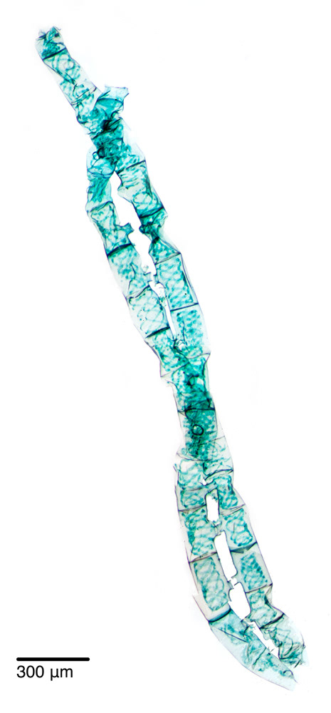 Spirogyia Conjugation, 4x