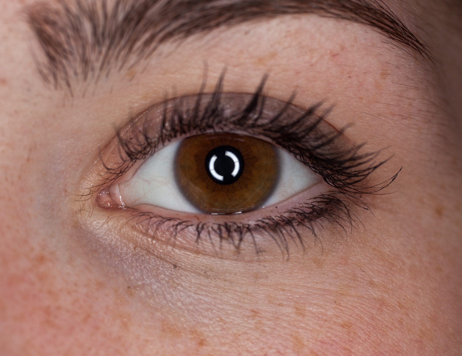 1:2 Iris Magnification