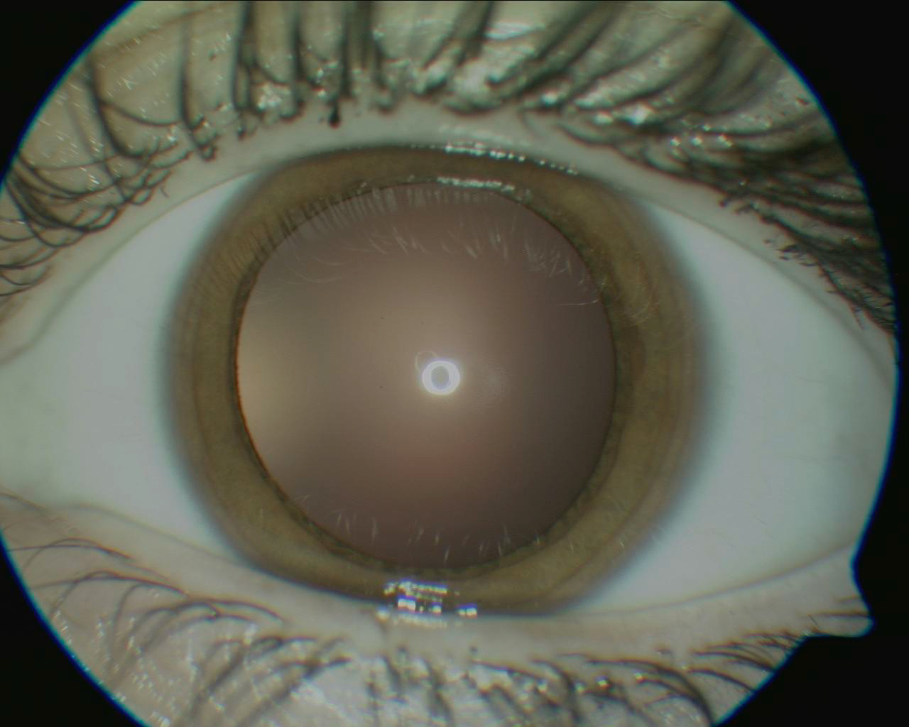 Exterior Iris