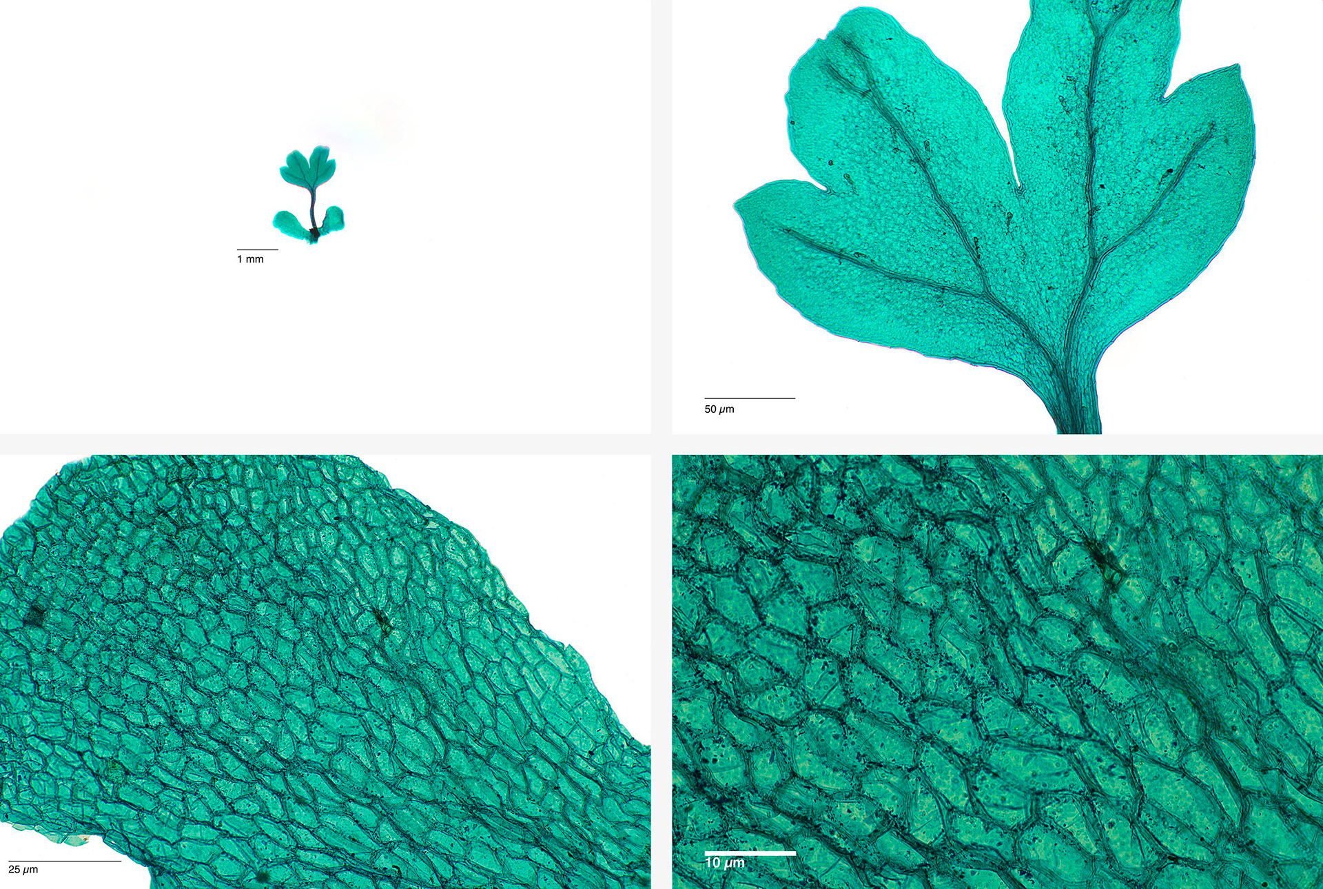 Fern Prothallia Sporangia Whole Mount