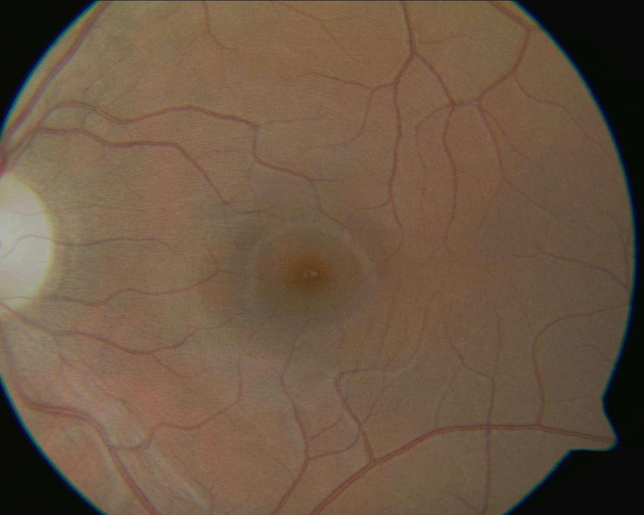Macula Centered