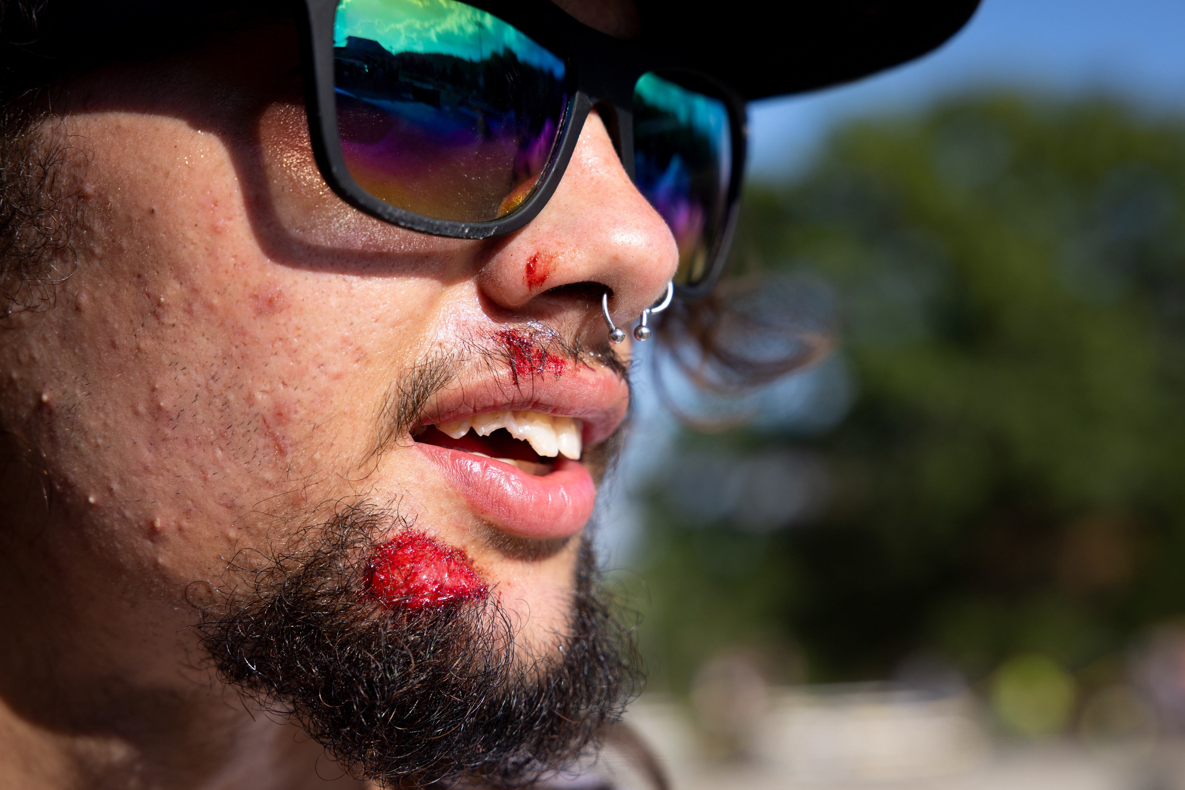 DJ Gonzalez shows a friend his broken teeth and wounds from a fall during Skate Jam’s Young Buck competition at Athens Skate Park in Athens, Sept. 21, 2024.