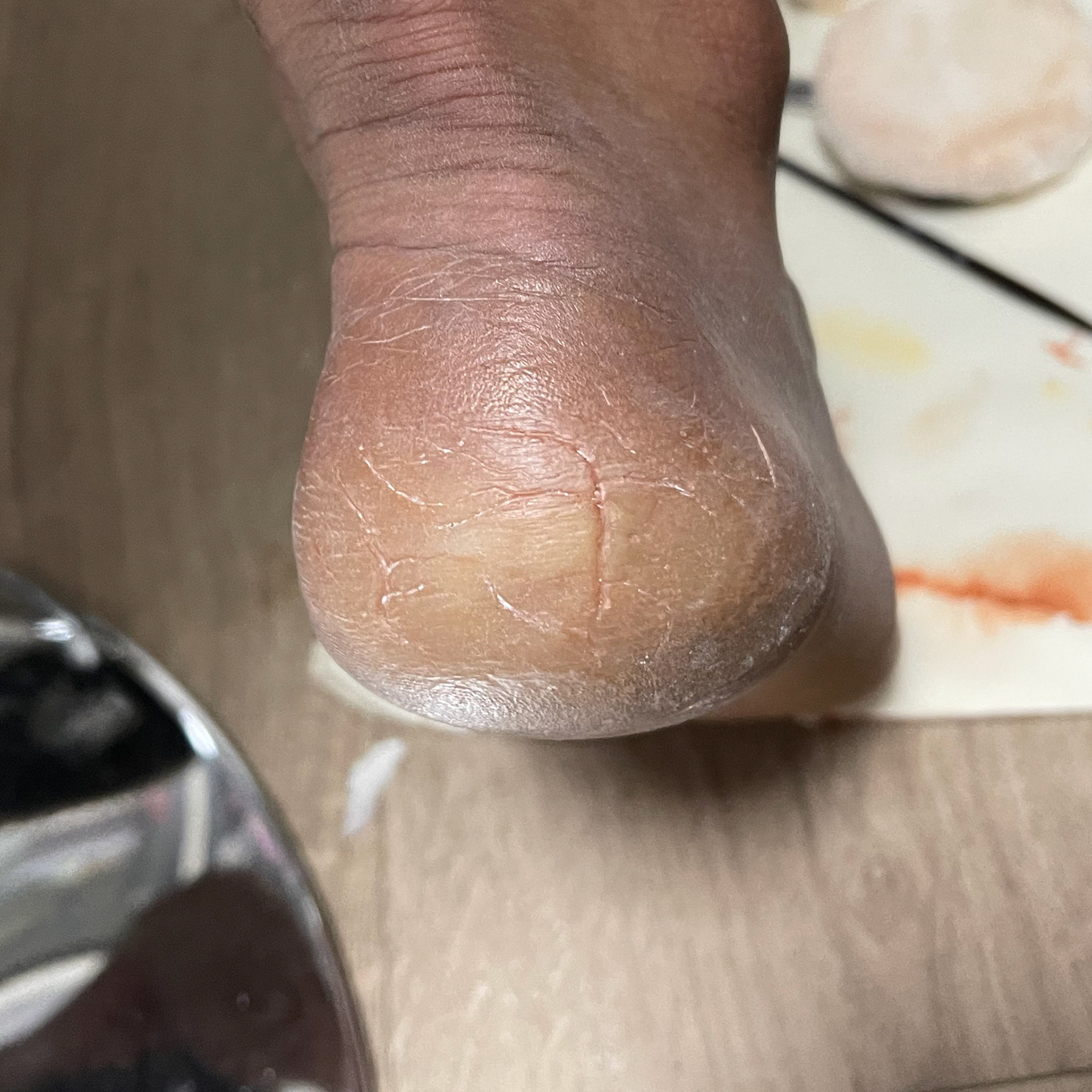 Application to Heel
