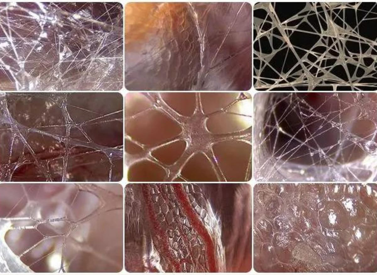 Fascia, connective and dividing (or compartmentalising) tissue.