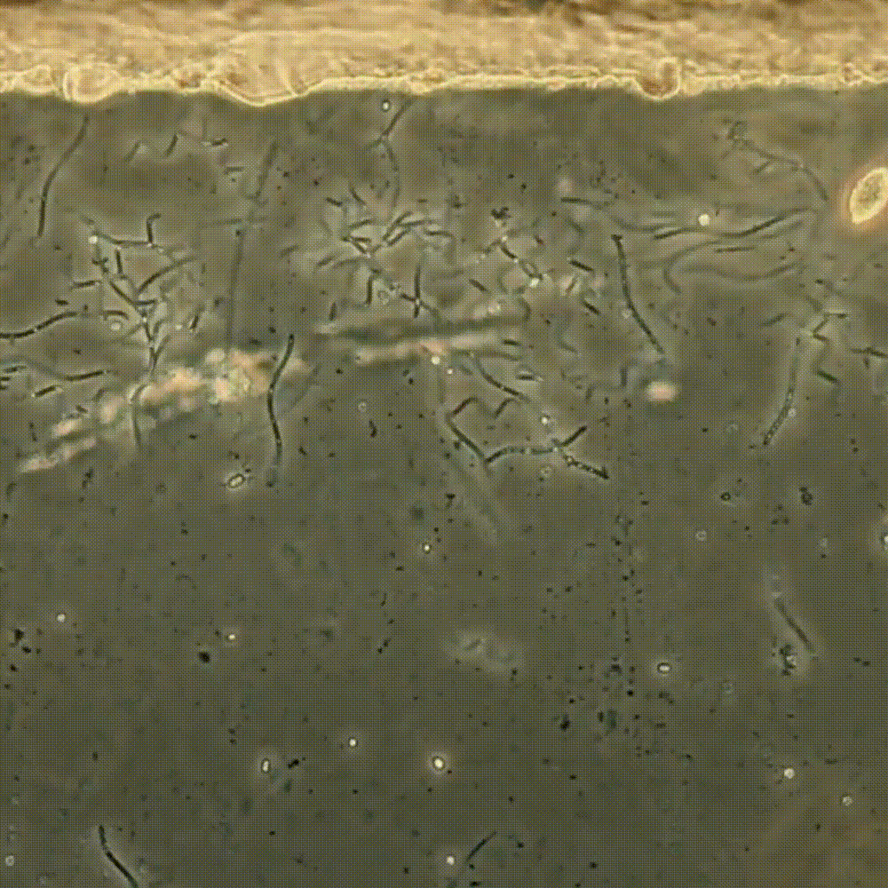 01: The original 2D microscopic recording.