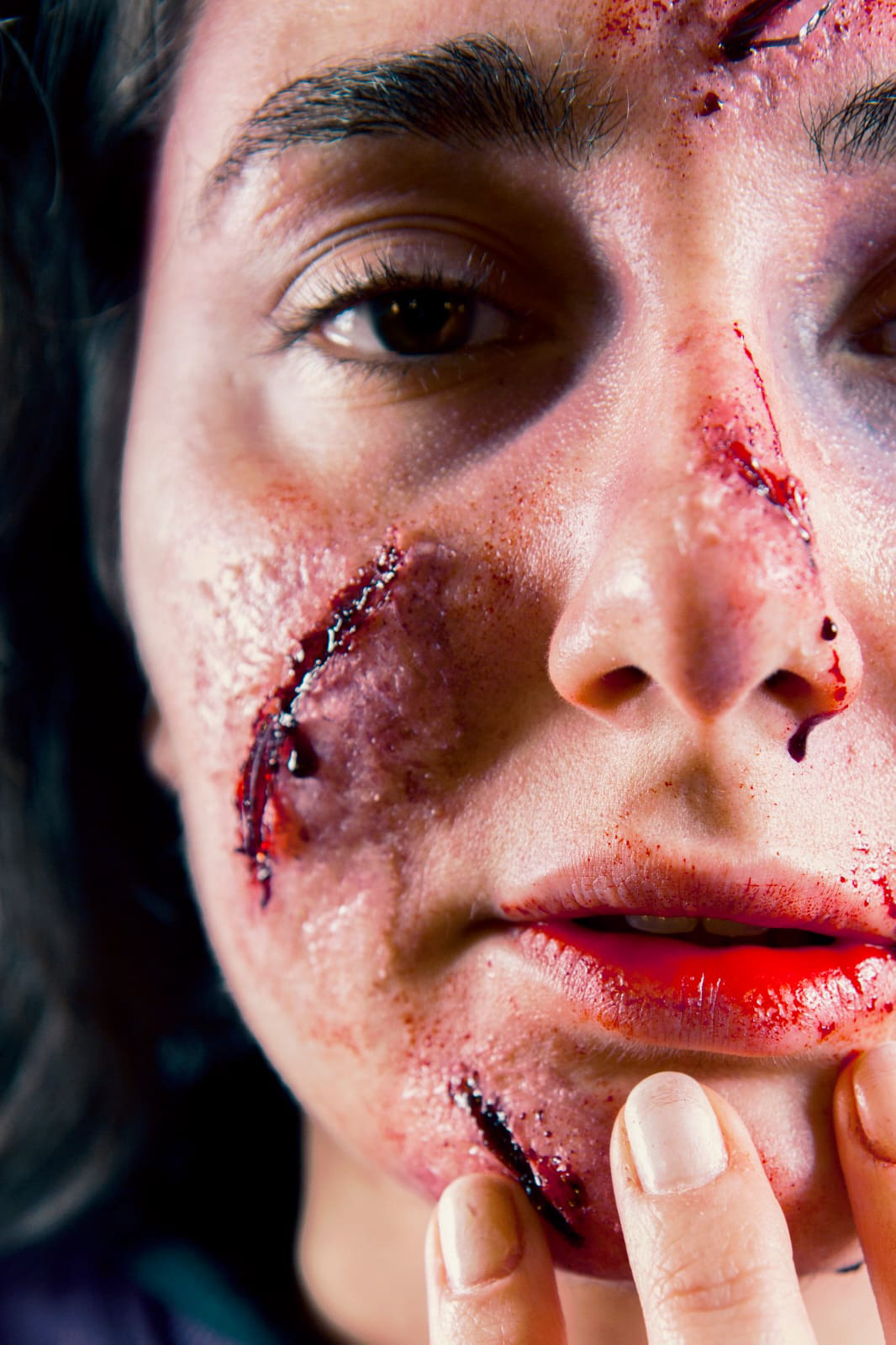 INCIDENTE STRADALE Tipologia: Sfx;  Caratteristiche: In questo look sono stati creati diversi effetti speciali estemporanei e protesi. Le protesi sono state realizzate da zero, partendo dalla scultura delle ferite fino alla colorazione e applicazione;  Type: Sfx; Features: This look features several spontaneous special effects and various prosthetics. The prosthetics were created from scratch, starting with the sculpting of wounds to the coloring and application; Makeup: Gino Aurora