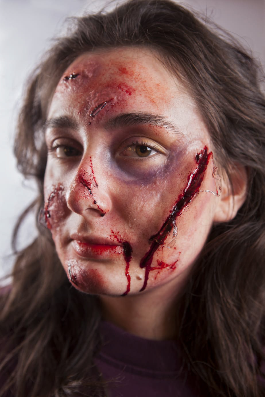 INCIDENTE STRADALE Tipologia: Sfx;  Caratteristiche: In questo look sono stati creati diversi effetti speciali estemporanei e protesi. Le protesi sono state realizzate da zero, partendo dalla scultura delle ferite fino alla colorazione e applicazione;  Type: Sfx; Features: This look features several spontaneous special effects and various prosthetics. The prosthetics were created from scratch, starting with the sculpting of wounds to the coloring and application; Makeup: Gino Aurora