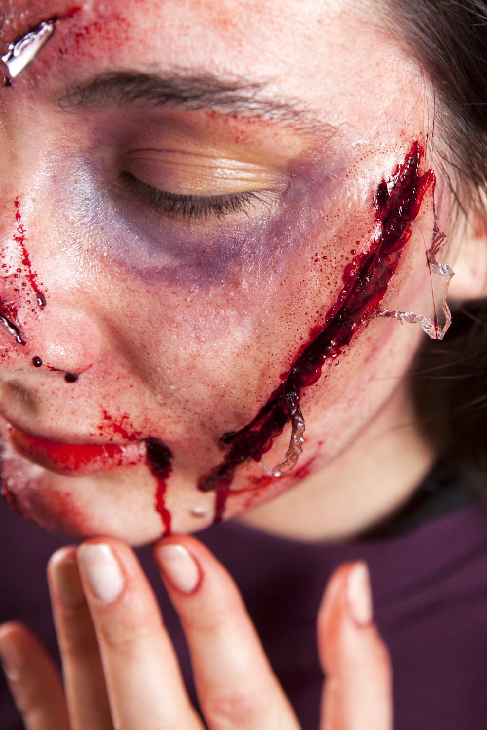 INCIDENTE STRADALE Tipologia: Sfx;  Caratteristiche: In questo look sono stati creati diversi effetti speciali estemporanei e protesi. Le protesi sono state realizzate da zero, partendo dalla scultura delle ferite fino alla colorazione e applicazione;  Type: Sfx; Features: This look features several spontaneous special effects and various prosthetics. The prosthetics were created from scratch, starting with the sculpting of wounds to the coloring and application; Makeup: Gino Aurora