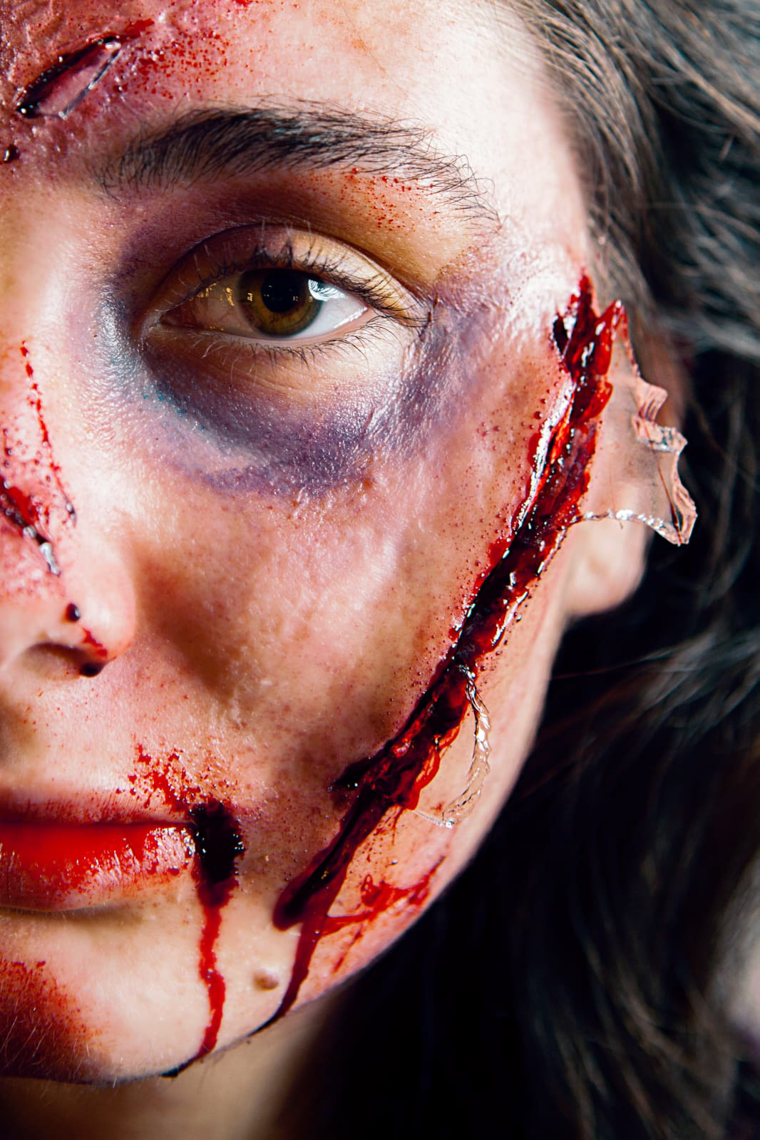 INCIDENTE STRADALE Tipologia: Sfx;  Caratteristiche: In questo look sono stati creati diversi effetti speciali estemporanei e protesi. Le protesi sono state realizzate da zero, partendo dalla scultura delle ferite fino alla colorazione e applicazione;  Type: Sfx; Features: This look features several spontaneous special effects and various prosthetics. The prosthetics were created from scratch, starting with the sculpting of wounds to the coloring and application; Makeup: Gino Aurora