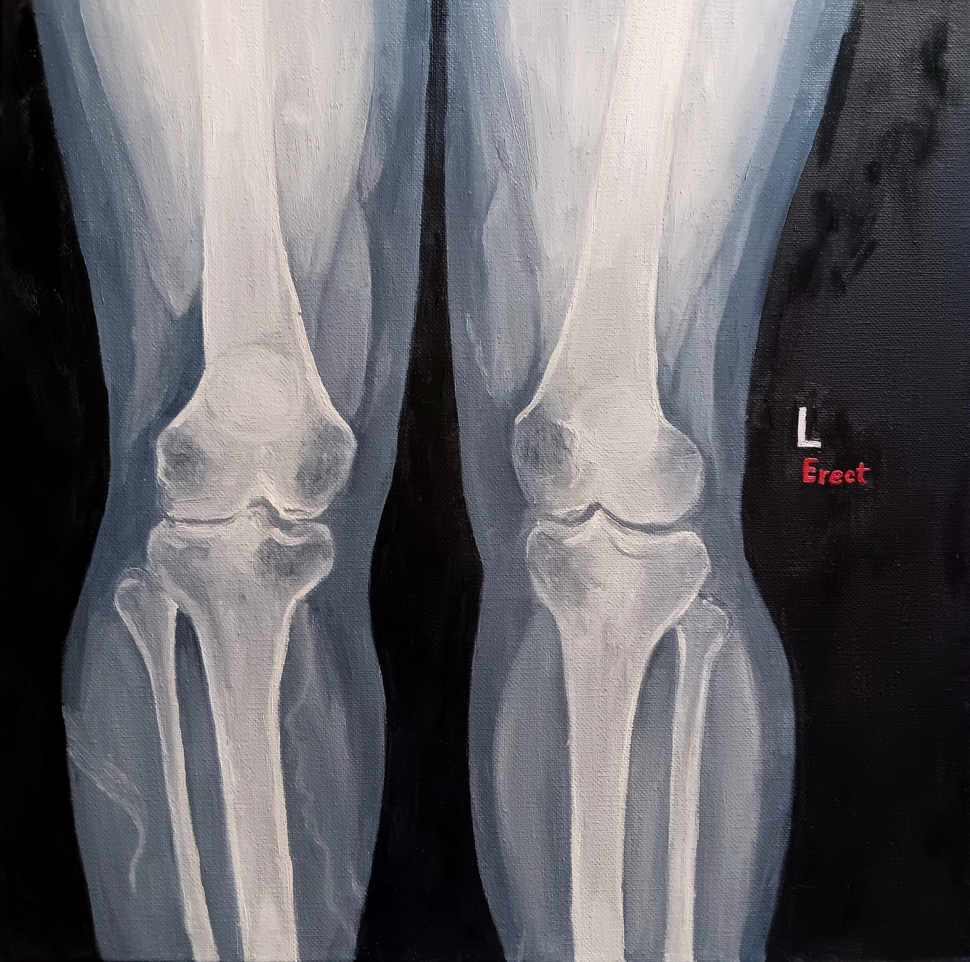 Knee X-Ray: Unknown Cause of Pain, Visual Art, Sarah Pienkos (Fine Arts)