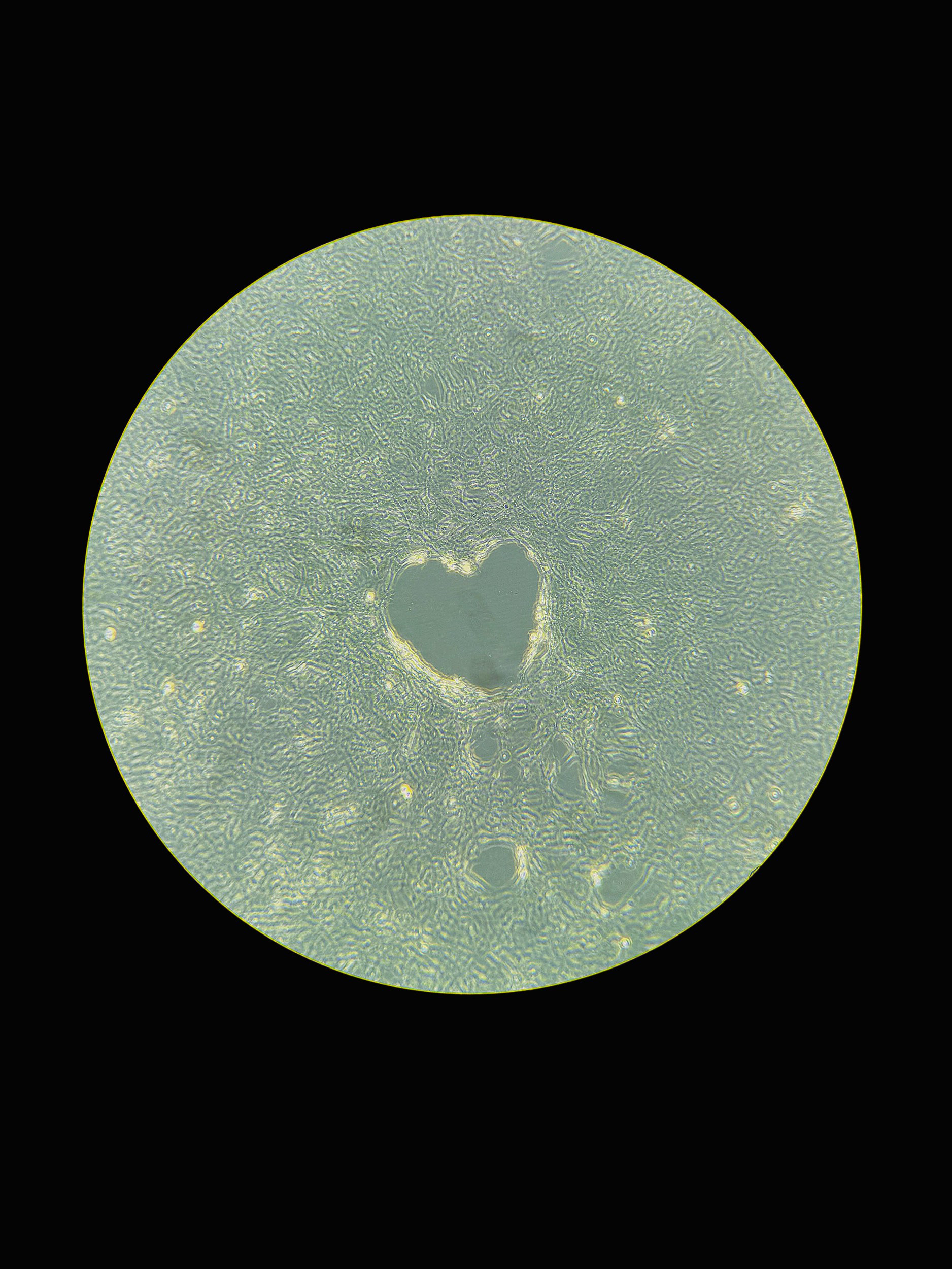 Cellular Love, Art In Science/STEAM, Ashna Patel, Medical Scholars 