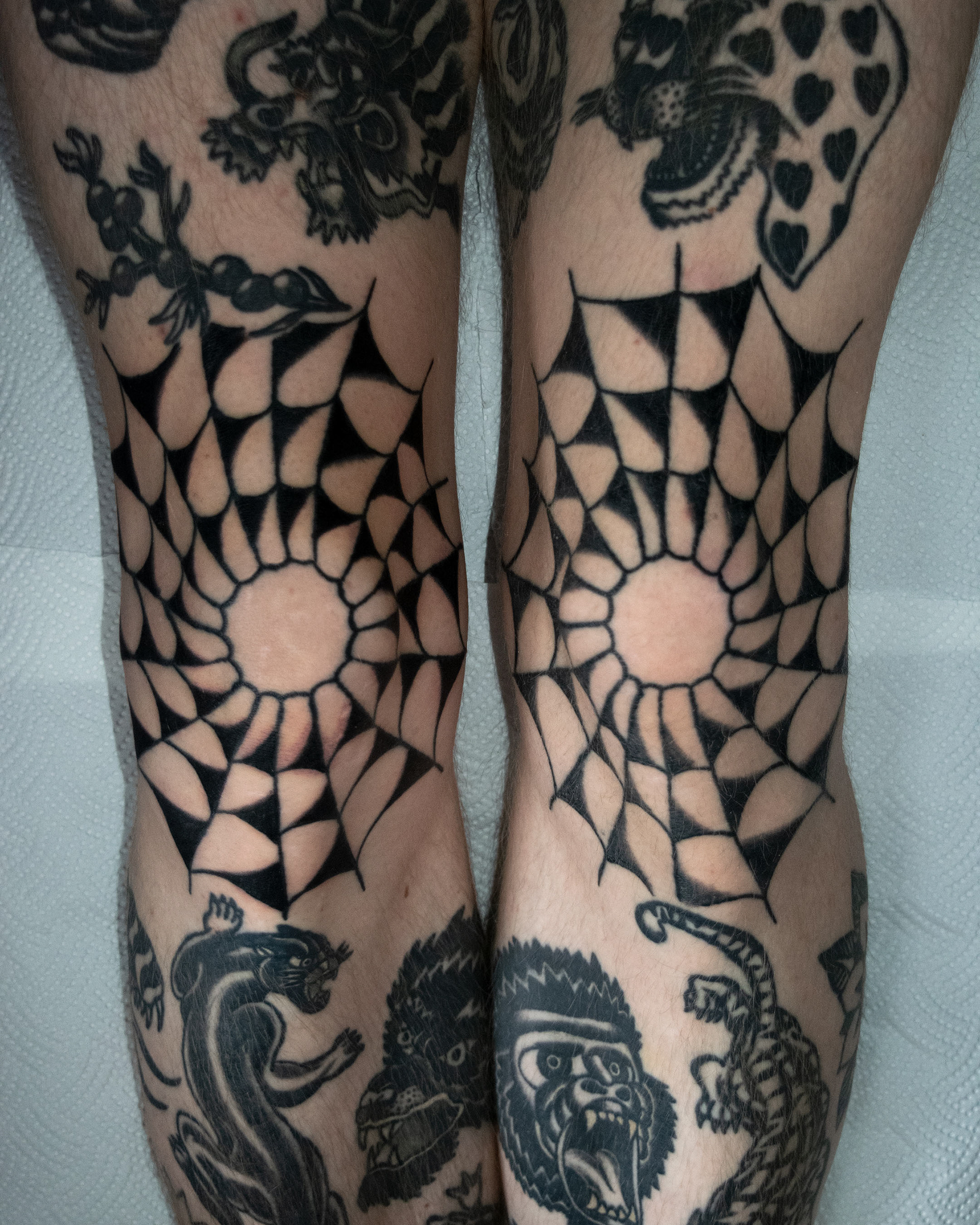 Left knee healed. Right knee healed lines, fresh shading.