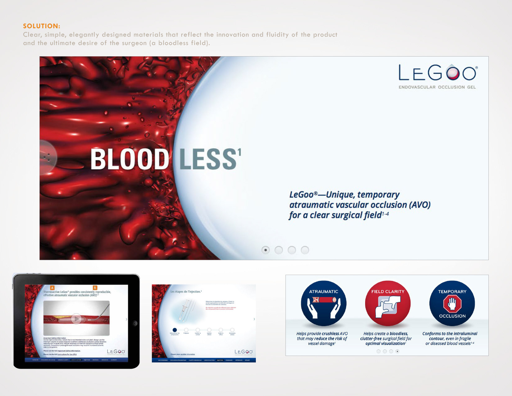 A bloodless field is what heart surgeons want