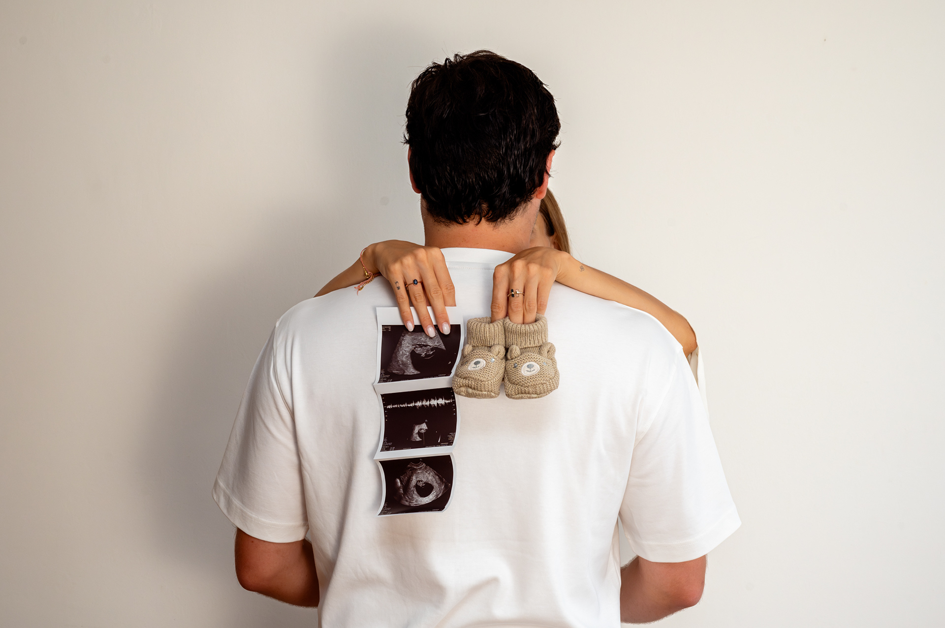 Ultrasound photos and knitted baby booties on the future dad's back