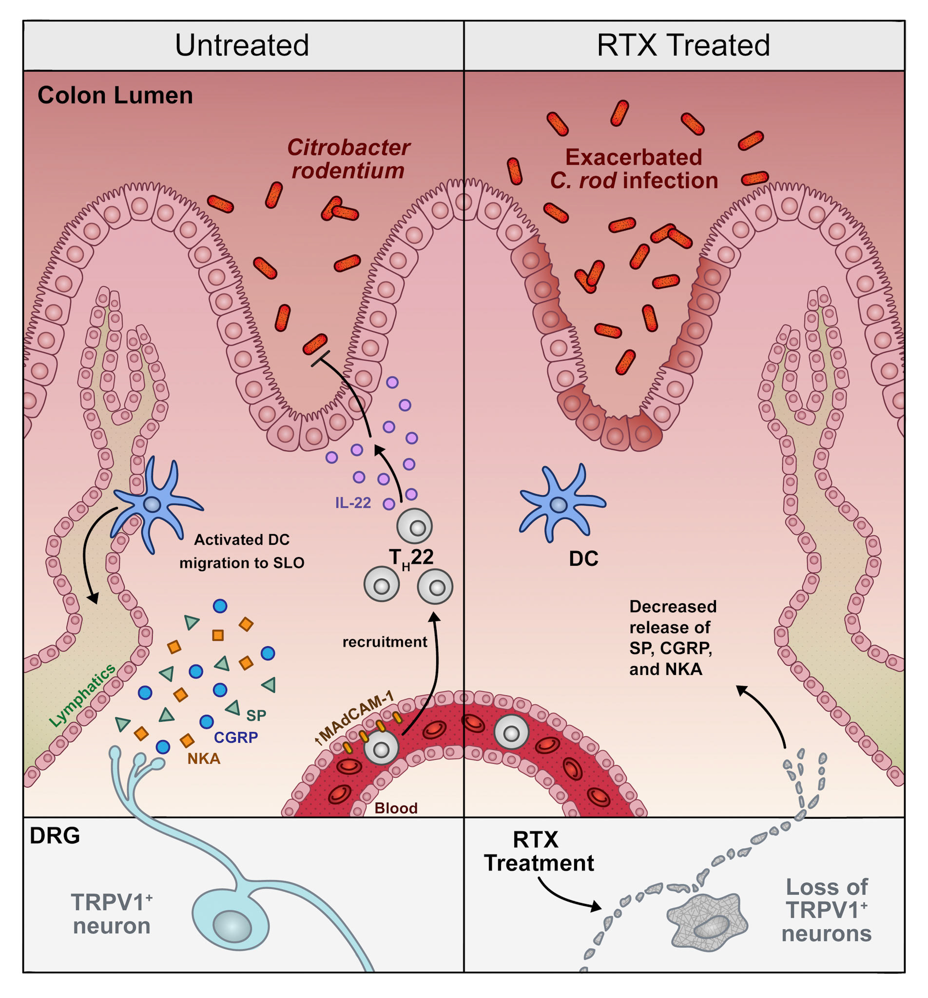 Alt Text: This is a clean scientific vector art illustration. I apologize, but I really cannot explain what is happening in this image clearly or succinctly. What I can say is the illustration depicts neurons, blood vessels, lymphatics, and various immune cells. It illustrates a process by which neural signals are modifying the immune system response to citrobacter rodentium infection in the gut.